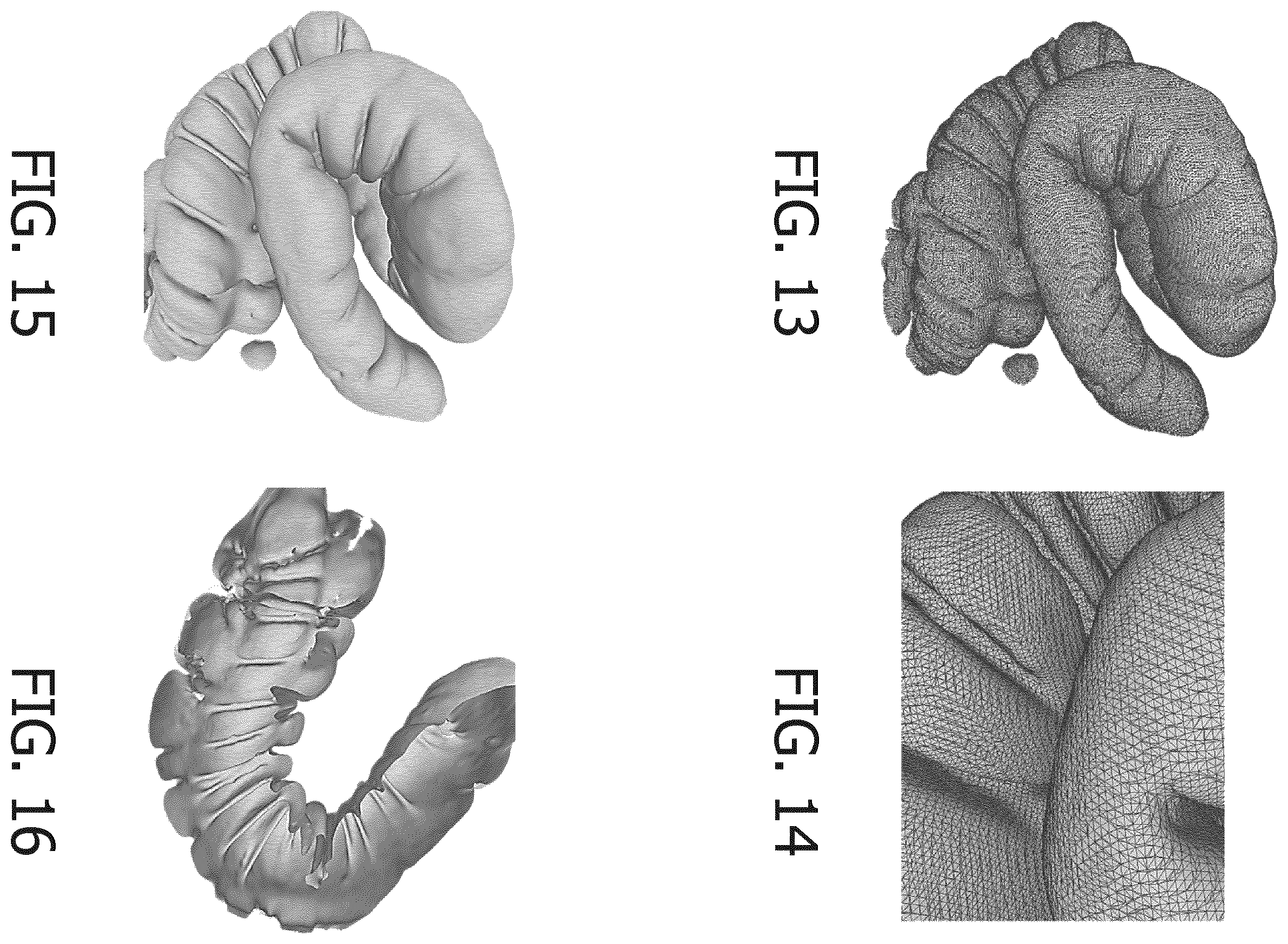 Patent US12586206 Figure 5 – Method for identifying a material boundary in volumetric image data