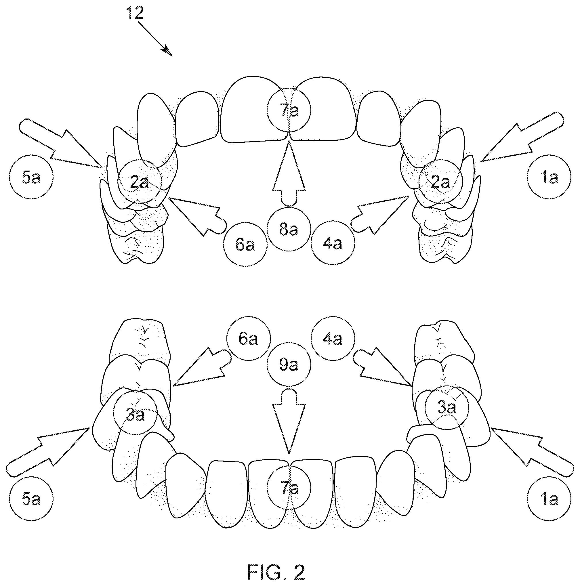 Patent US12586208 Figure 2 – Apparatus and method for operating a dental appliance