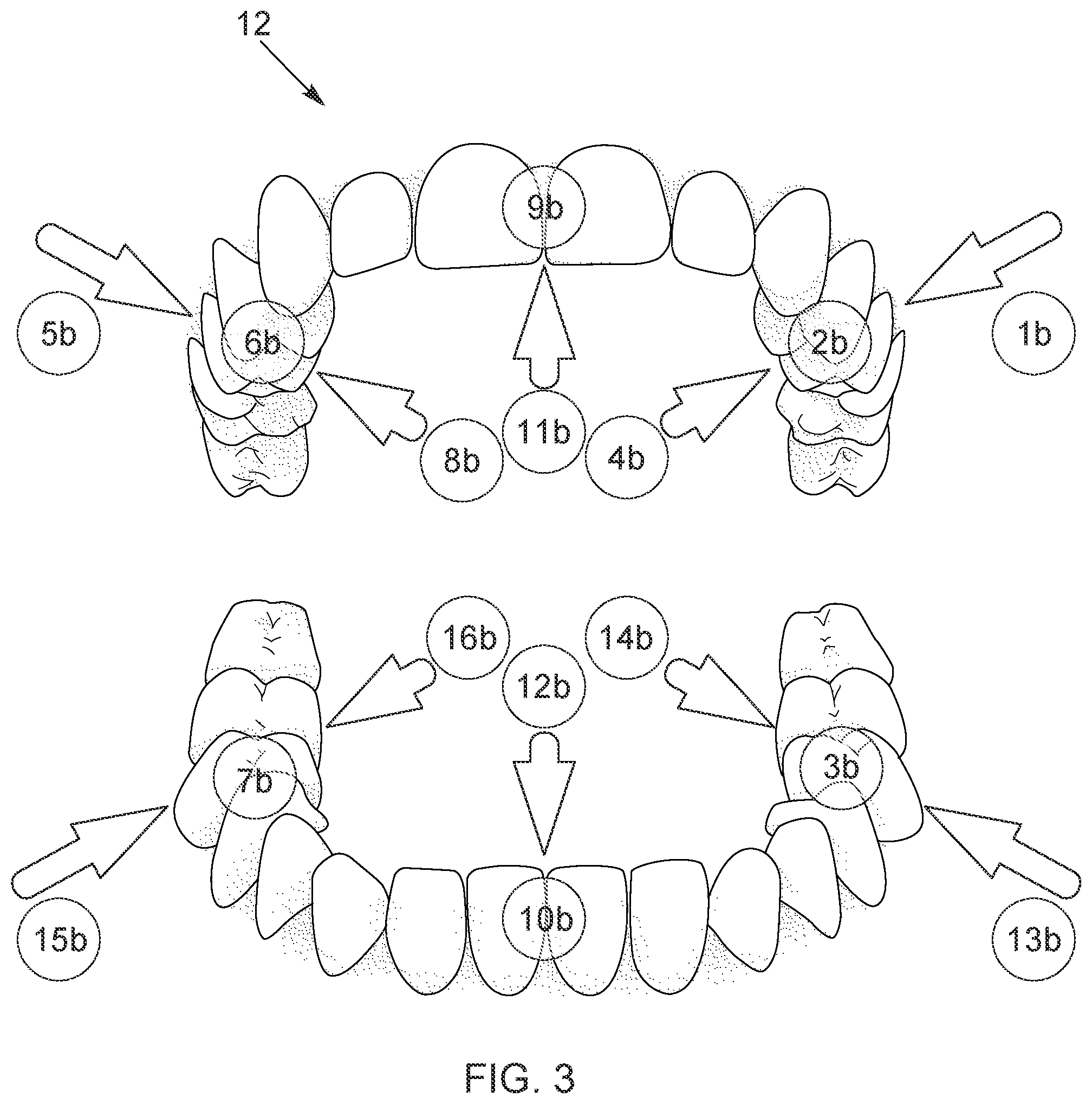 Patent US12586208 Figure 3 – Apparatus and method for operating a dental appliance
