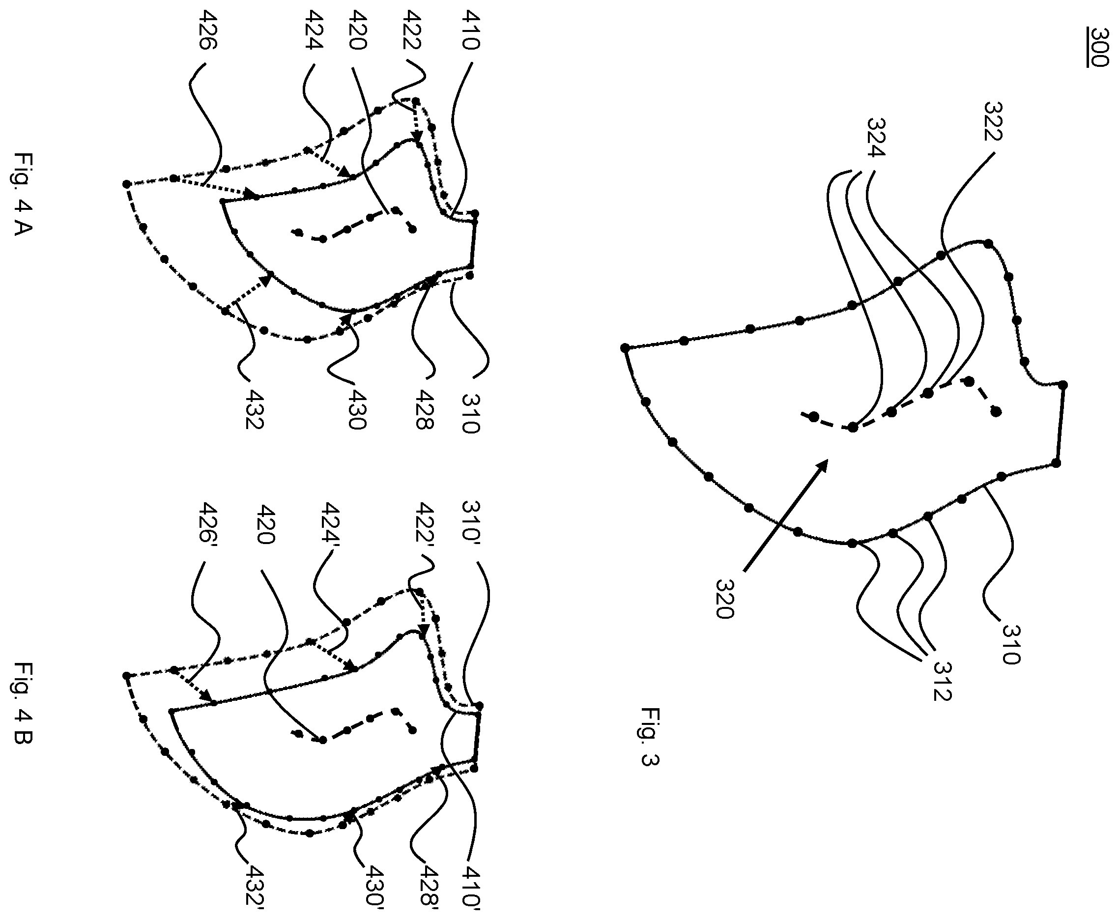Patent US12586216 Figure 3 – Method of determining a motion of a heart wall