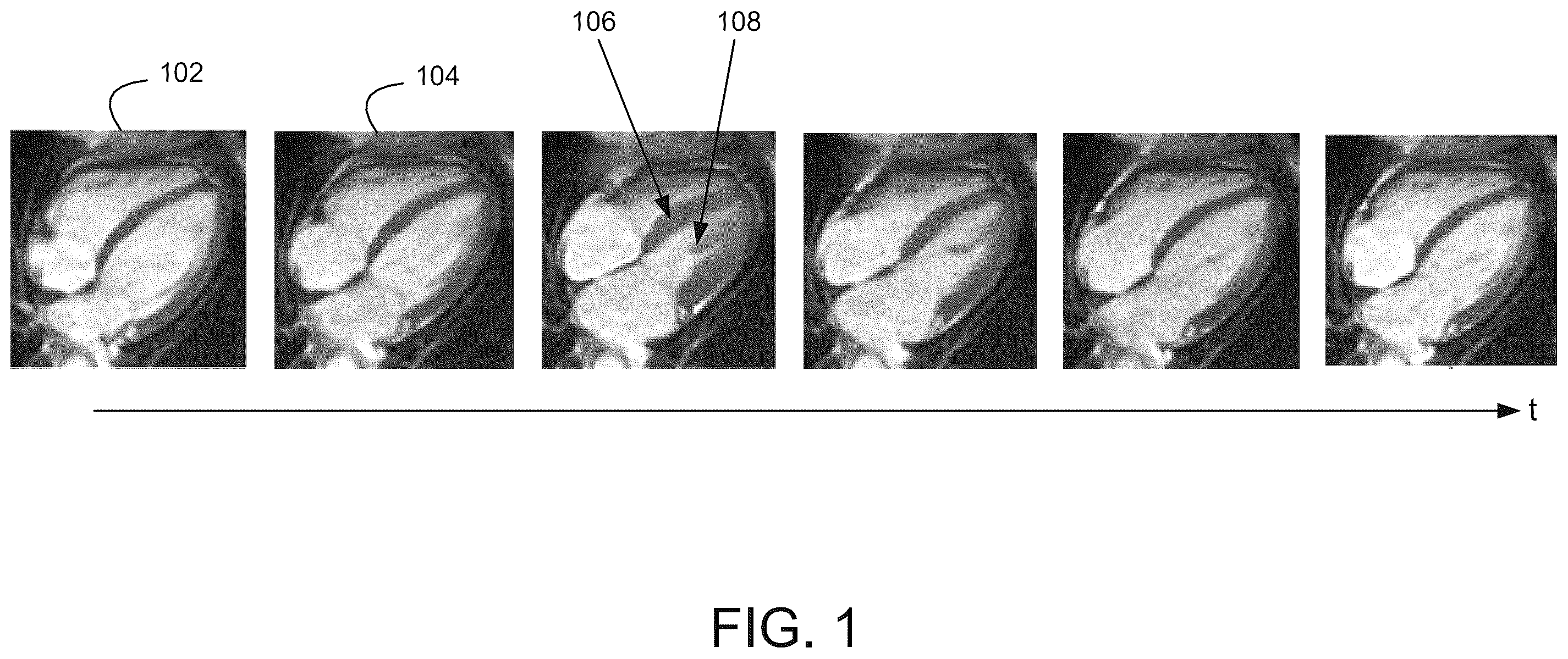 Patent US12586218 Figure 1 – Motion estimation with anatomical integrity