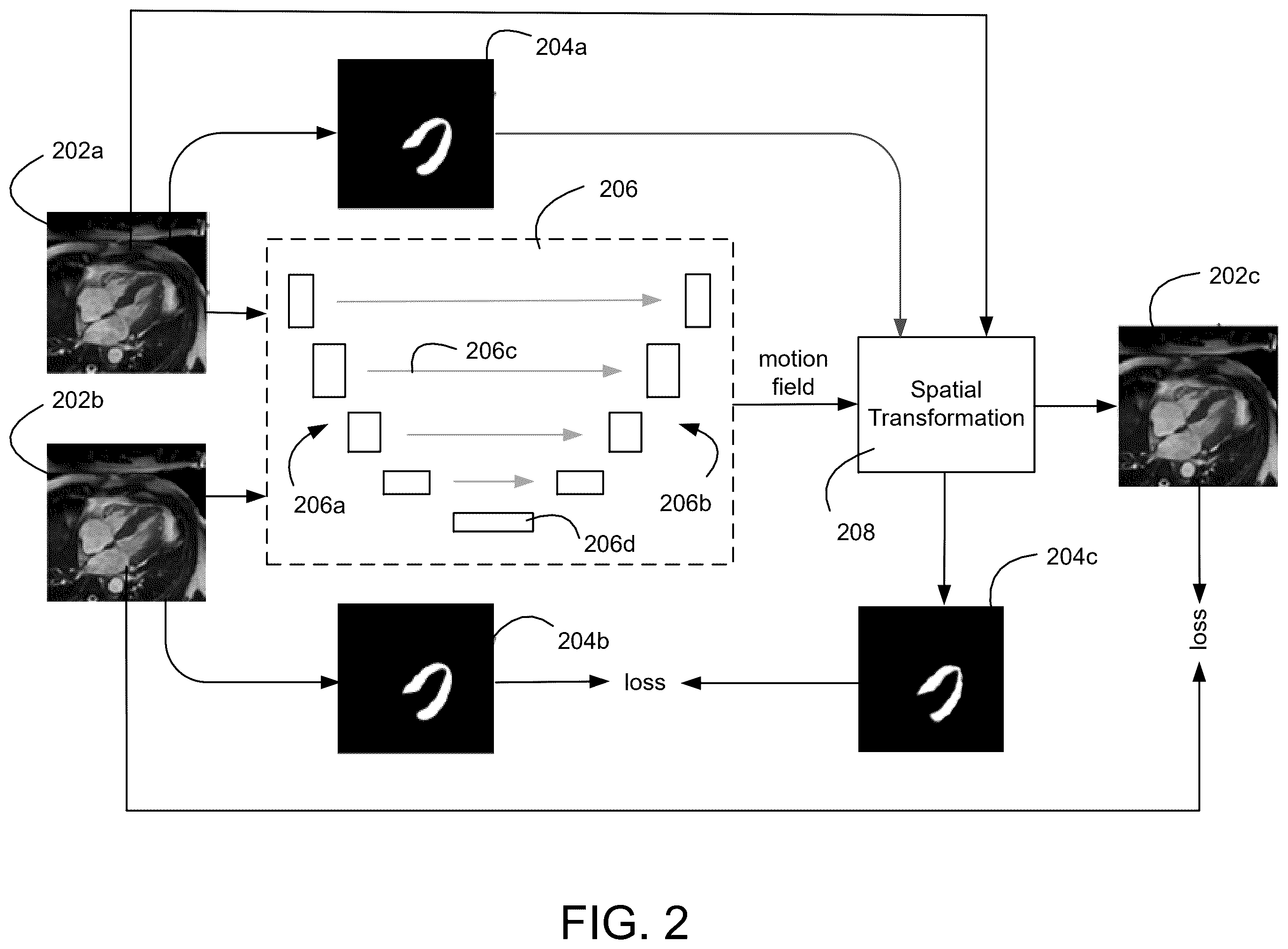 Patent US12586218 Figure 2 – Motion estimation with anatomical integrity