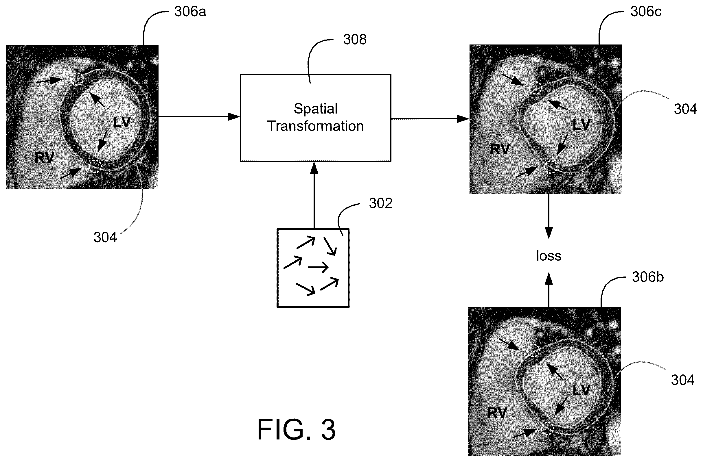 Patent US12586218 Figure 3 – Motion estimation with anatomical integrity