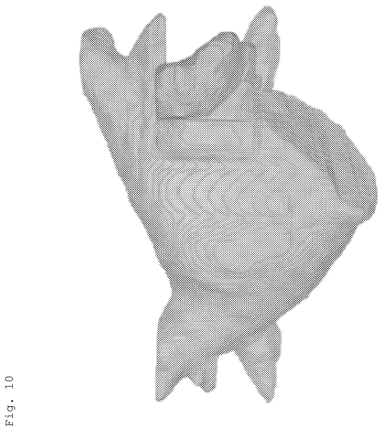 Patent US12586228 Figure 10 – Device and method for calculating atrial wall thickness
