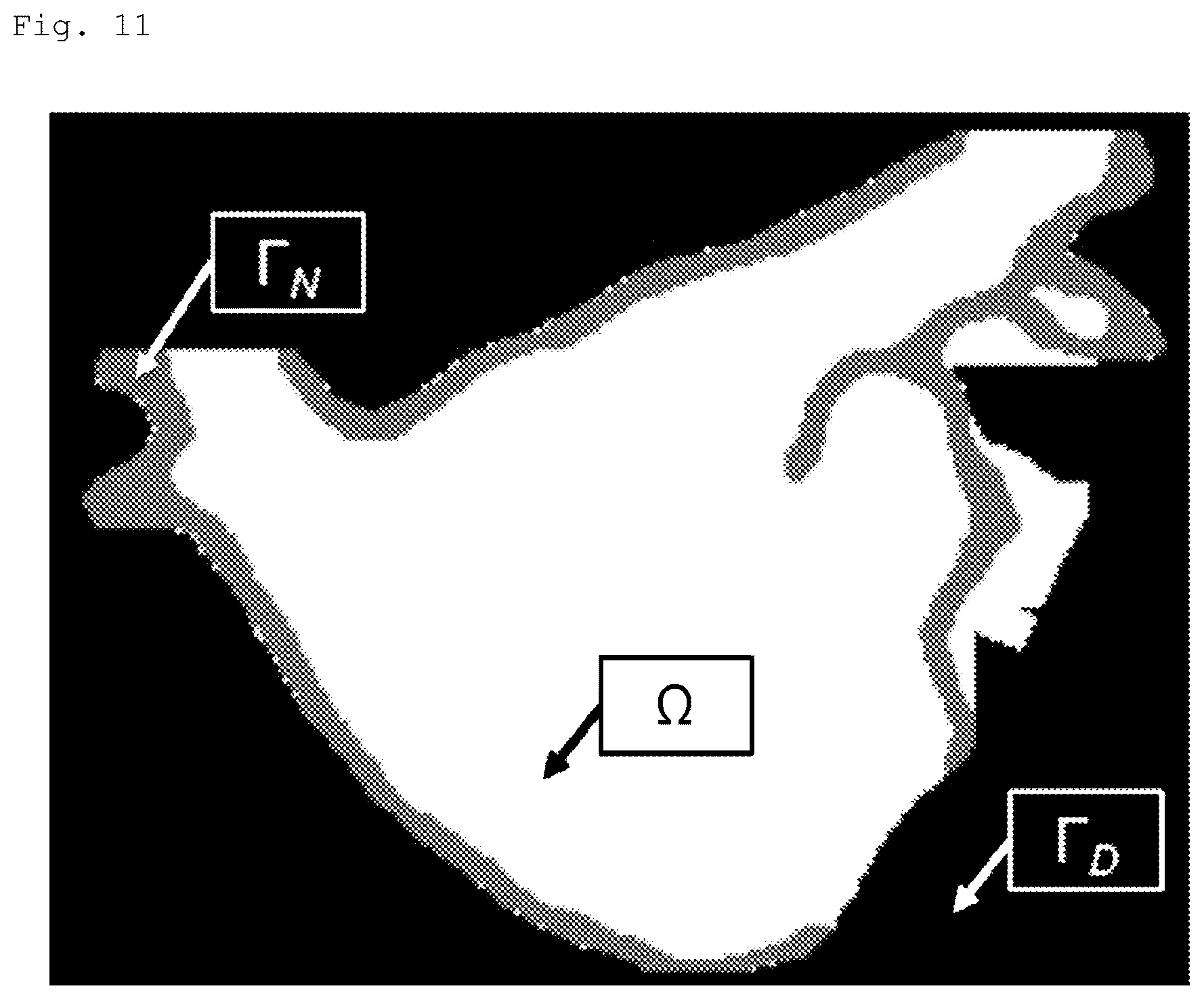 Patent US12586228 Figure 11 – Device and method for calculating atrial wall thickness