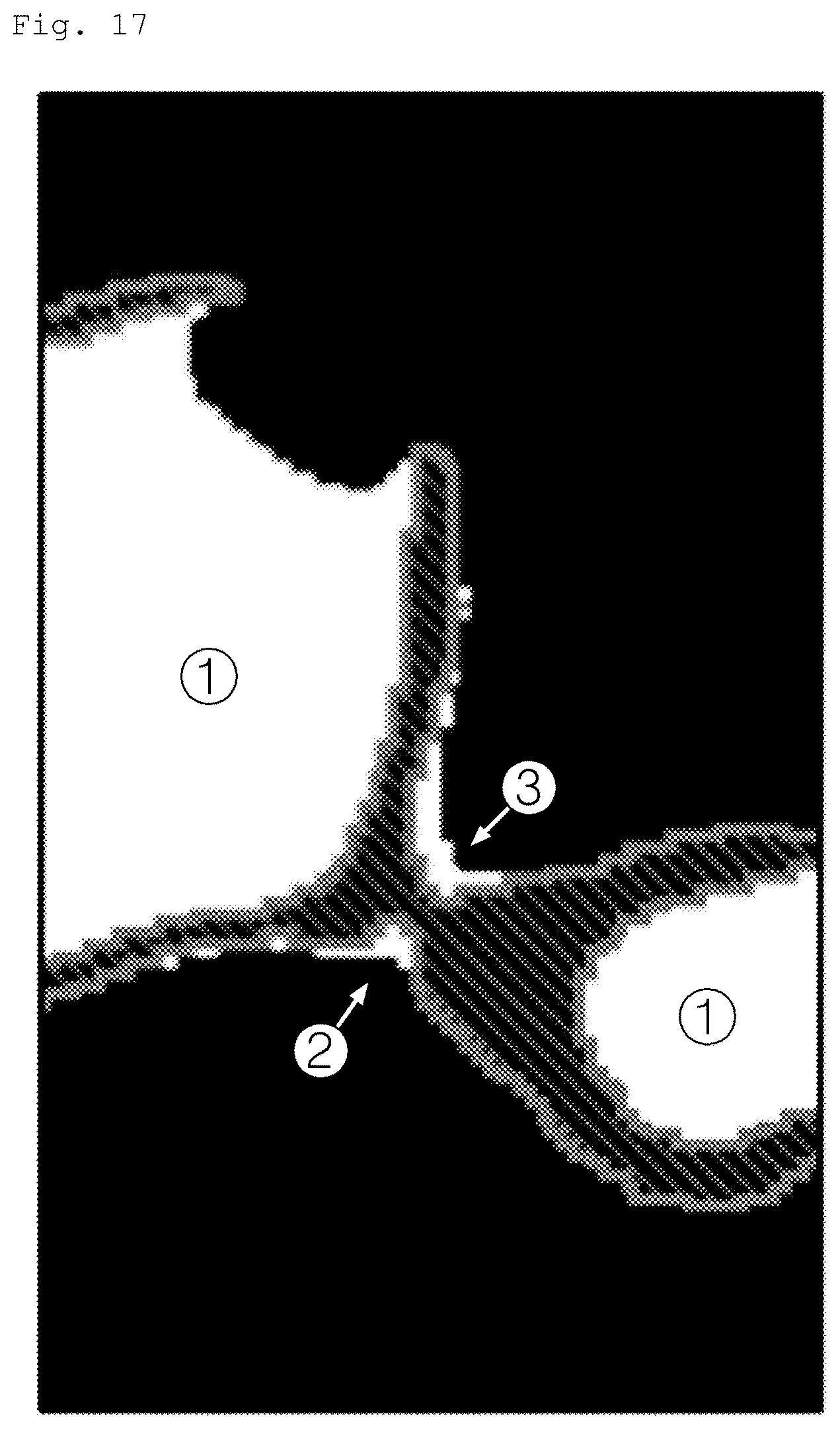 Patent US12586228 Figure 17 – Device and method for calculating atrial wall thickness