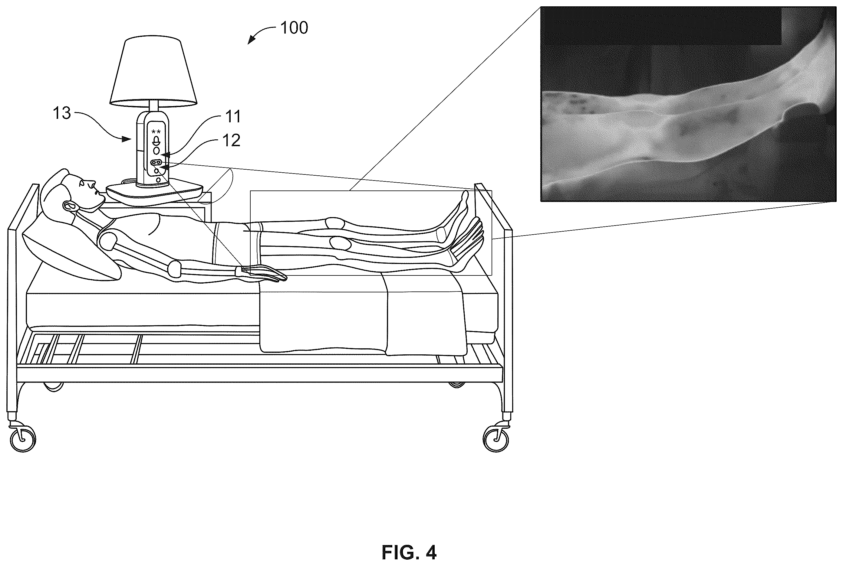 Patent US12586243 Figure 7 – Monitoring apparatus and method for preventing pressure injuries