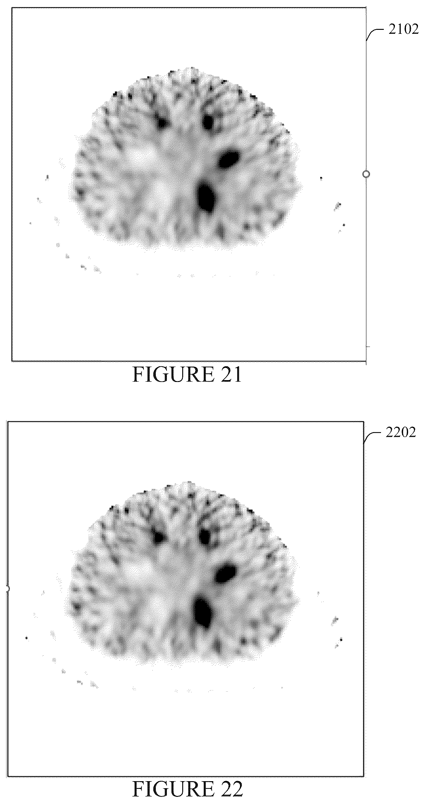 Patent US12586276 Figure 10 – System, method and/or computer readable medium for mitigation of effects from photon septal penetration in SPECT imaging
