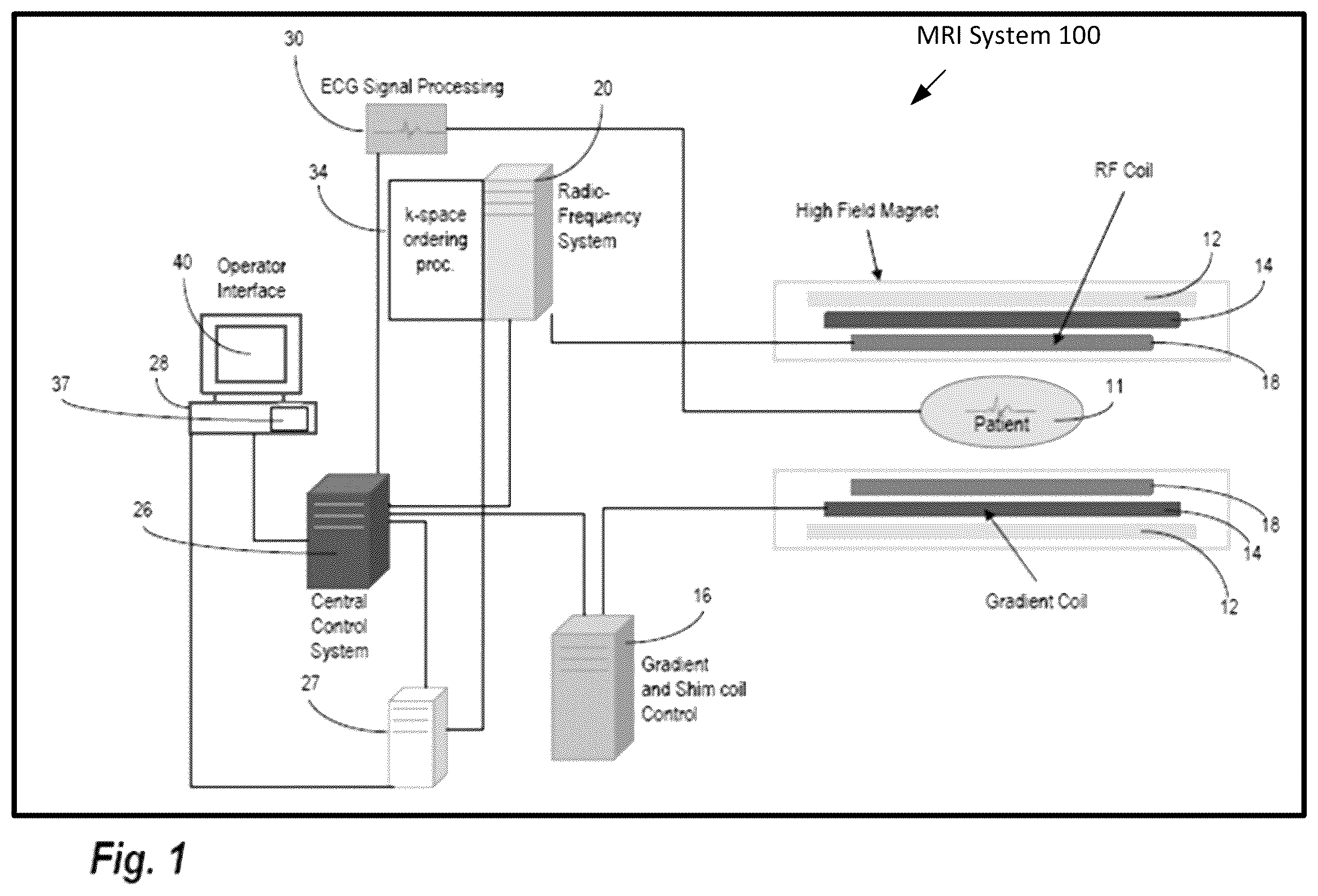 Patent US12586277 Figure 1 – Quasi-Newton MRI deep learning reconstruction