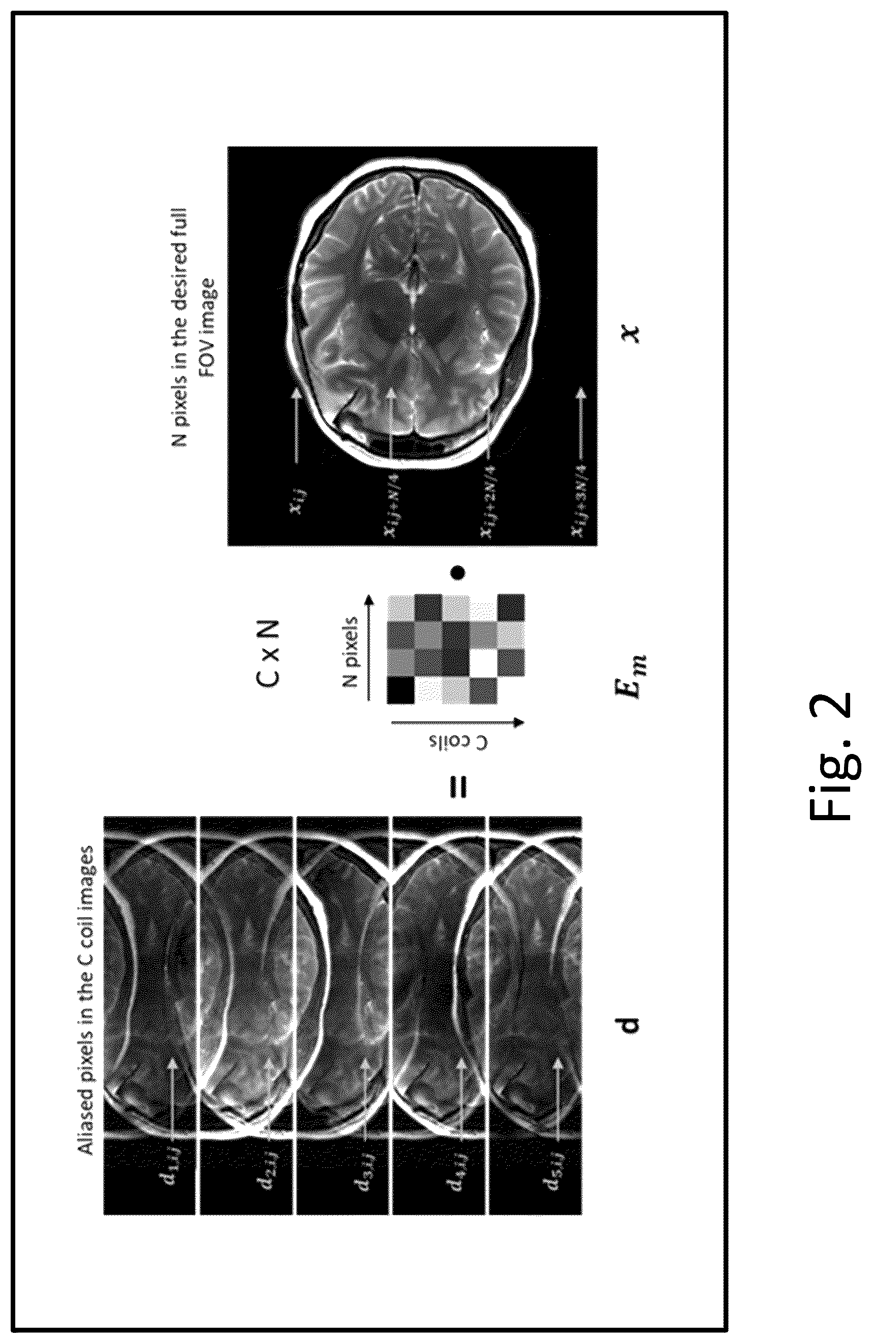 Patent US12586277 Figure 2 – Quasi-Newton MRI deep learning reconstruction
