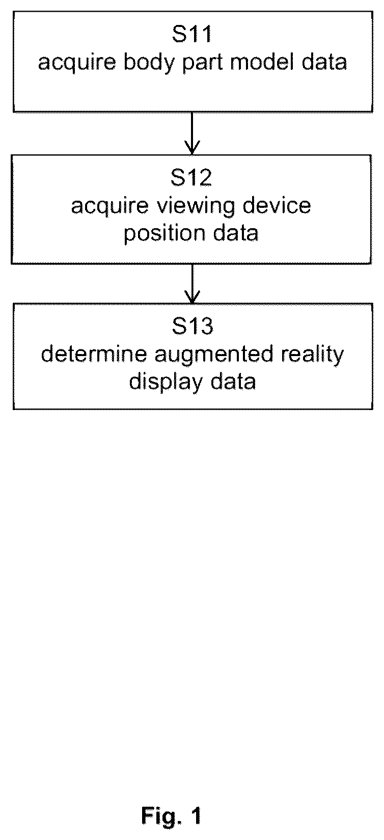 Patent US12586324 Figure 1 – Spine level determination using augmented reality
