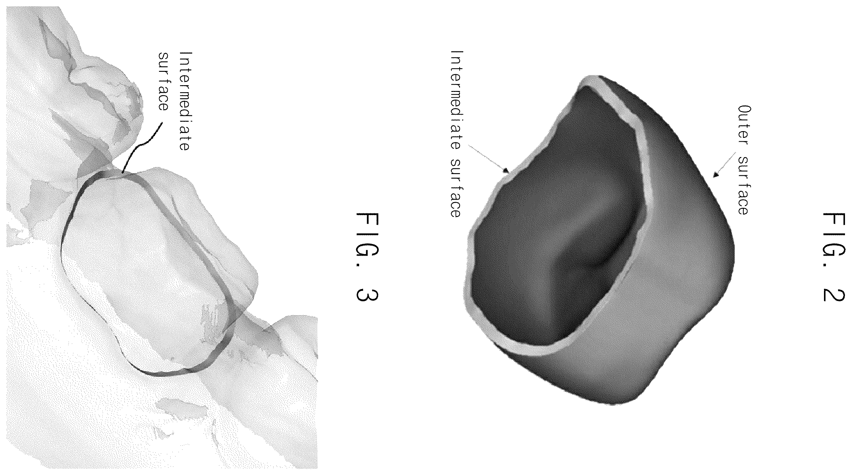 Patent US12586333 Figure 2 – Automated method for generating prosthesis from three dimensional scan data, apparatus generating prosthesis from three dimensional scan data and computer readable medium having program for performing the method