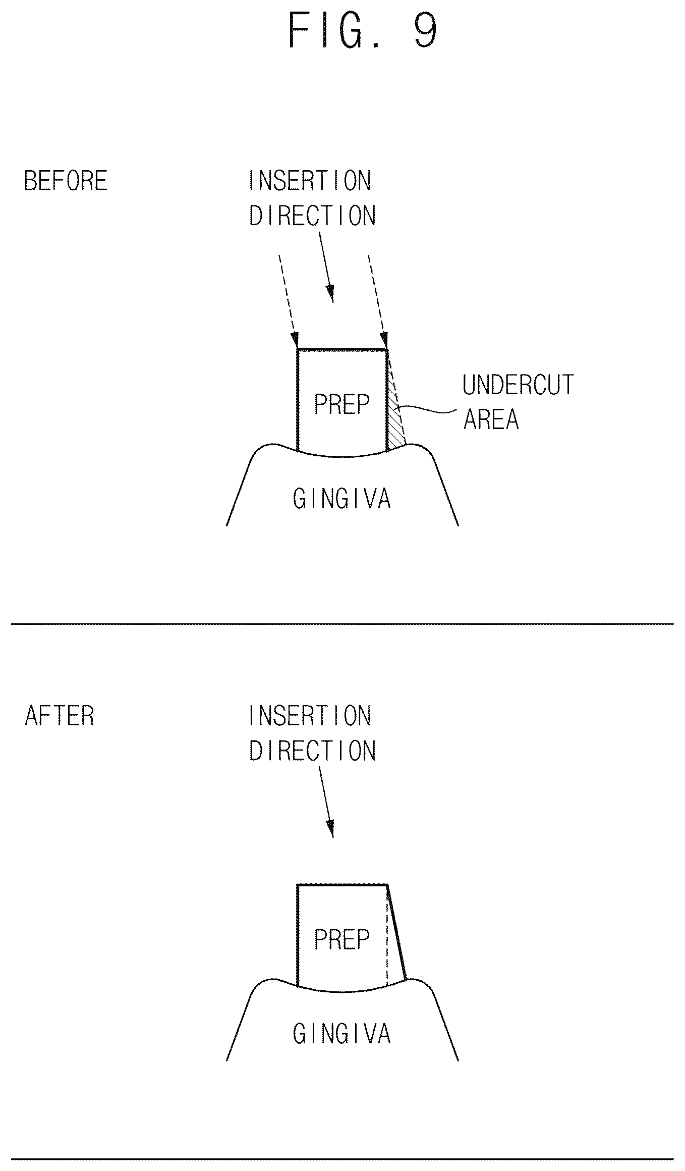 Patent US12586333 Figure 6 – Automated method for generating prosthesis from three dimensional scan data, apparatus generating prosthesis from three dimensional scan data and computer readable medium having program for performing the method
