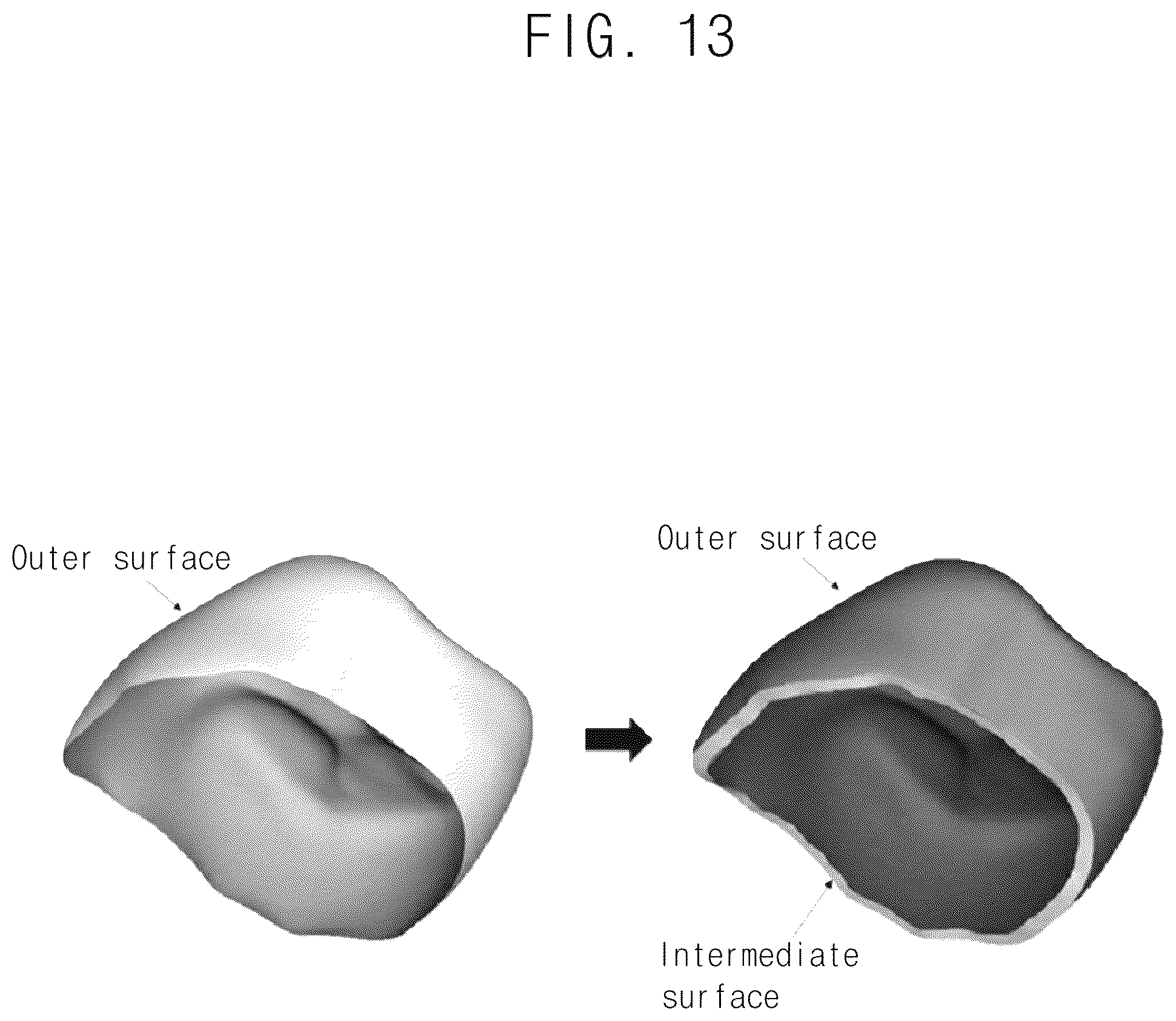 Patent US12586333 Figure 10 – Automated method for generating prosthesis from three dimensional scan data, apparatus generating prosthesis from three dimensional scan data and computer readable medium having program for performing the method