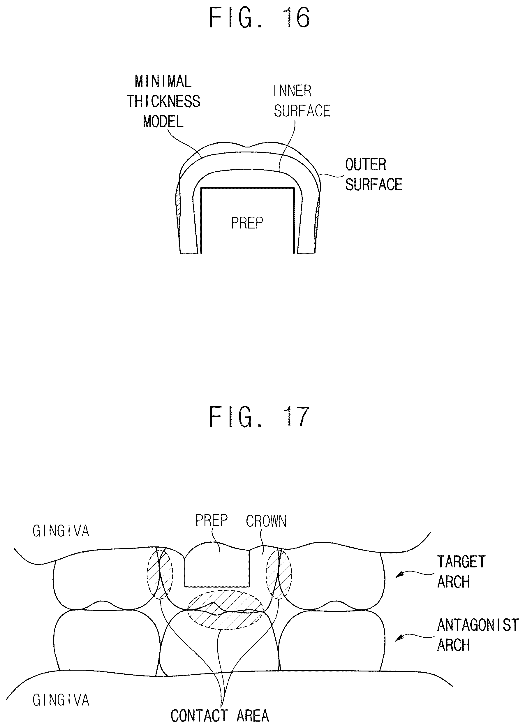 Patent US12586333 Figure 12 – Automated method for generating prosthesis from three dimensional scan data, apparatus generating prosthesis from three dimensional scan data and computer readable medium having program for performing the method
