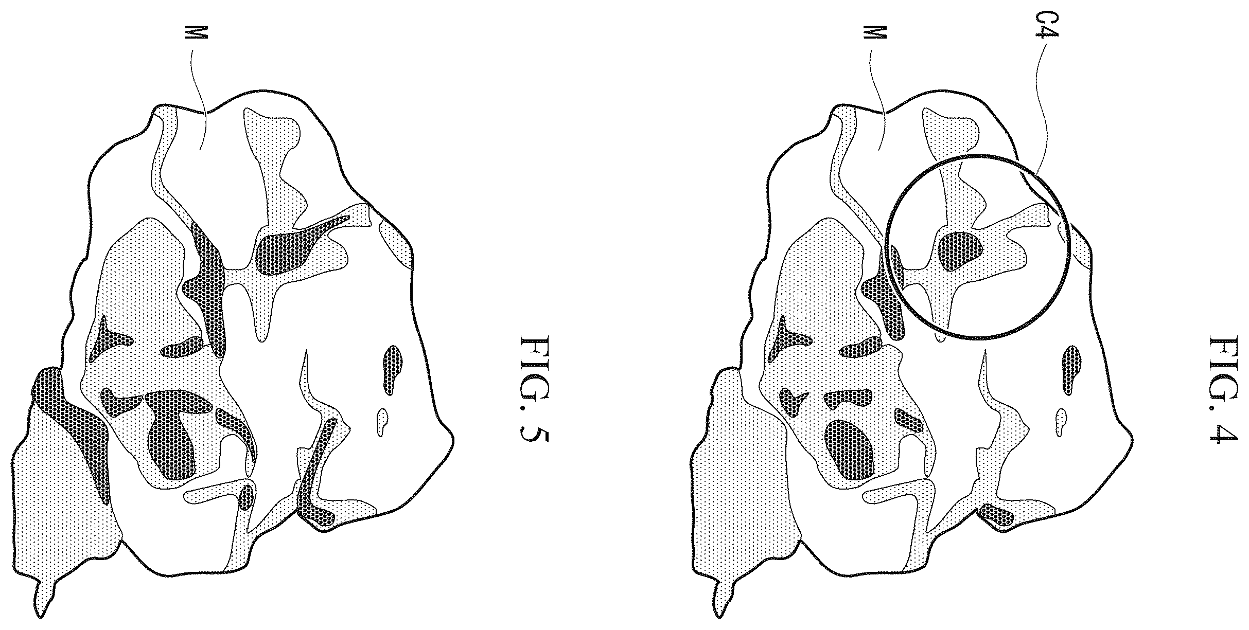 Patent US12586337 Figure 4 – Target detection device, machine learning implementation device, target detection program, and machine learning implementation program