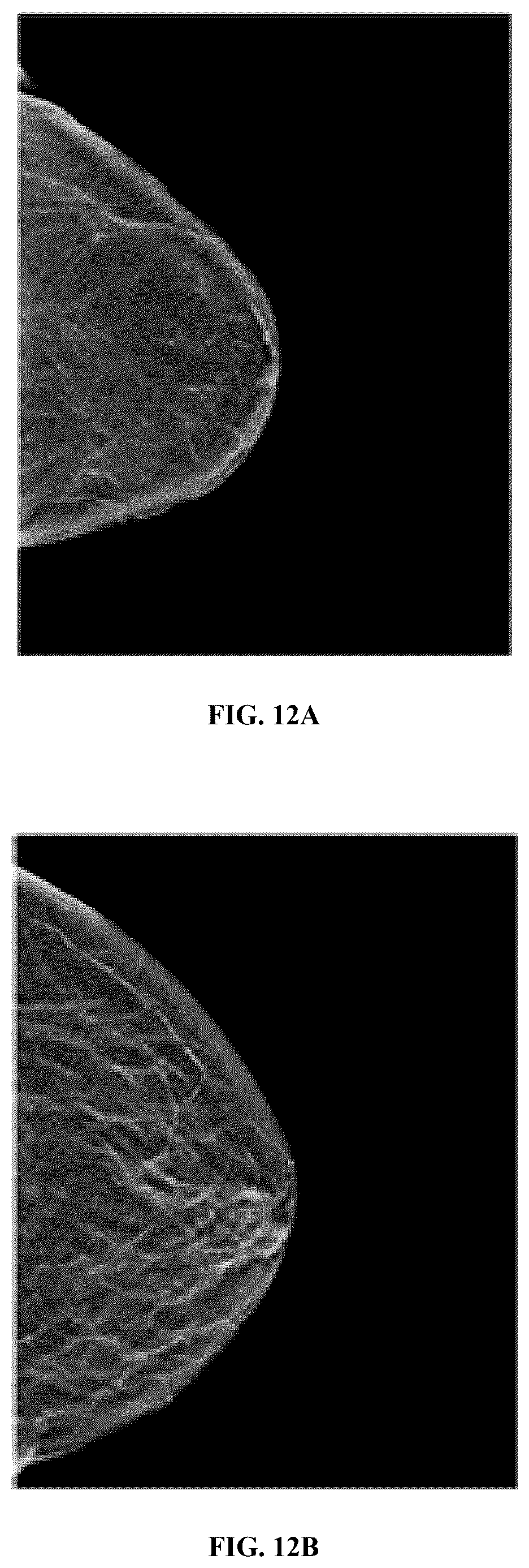 Patent US12586360 Figure 15 – Methods and systems for monitoring and surveillance of autonomous AI in medical imaging