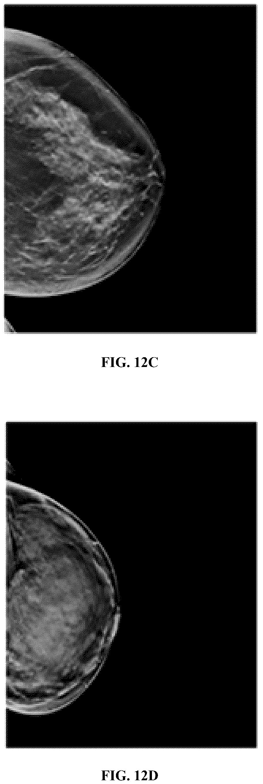 Patent US12586360 Figure 16 – Methods and systems for monitoring and surveillance of autonomous AI in medical imaging