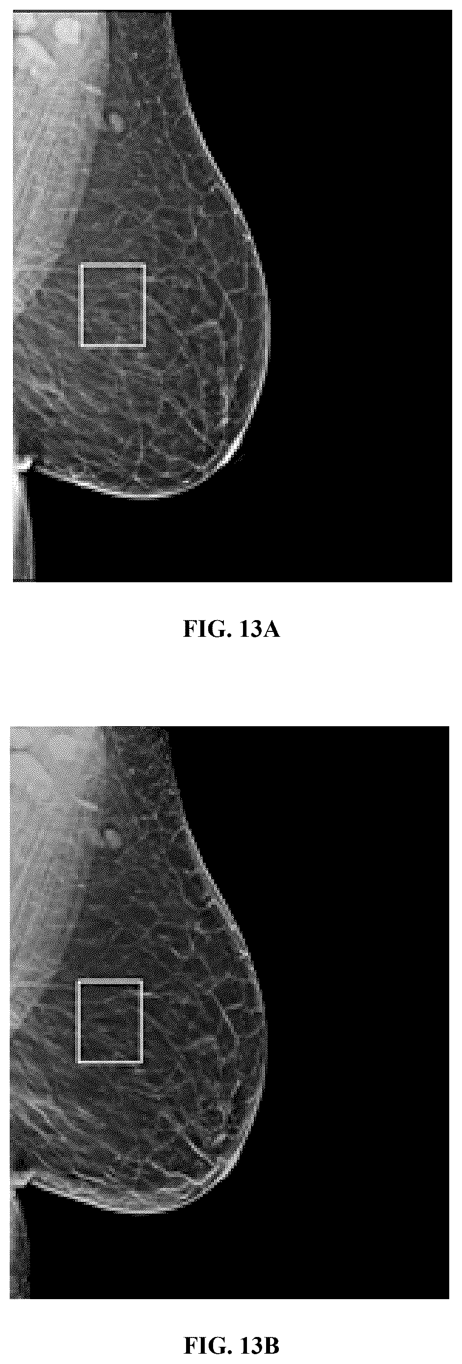 Patent US12586360 Figure 17 – Methods and systems for monitoring and surveillance of autonomous AI in medical imaging