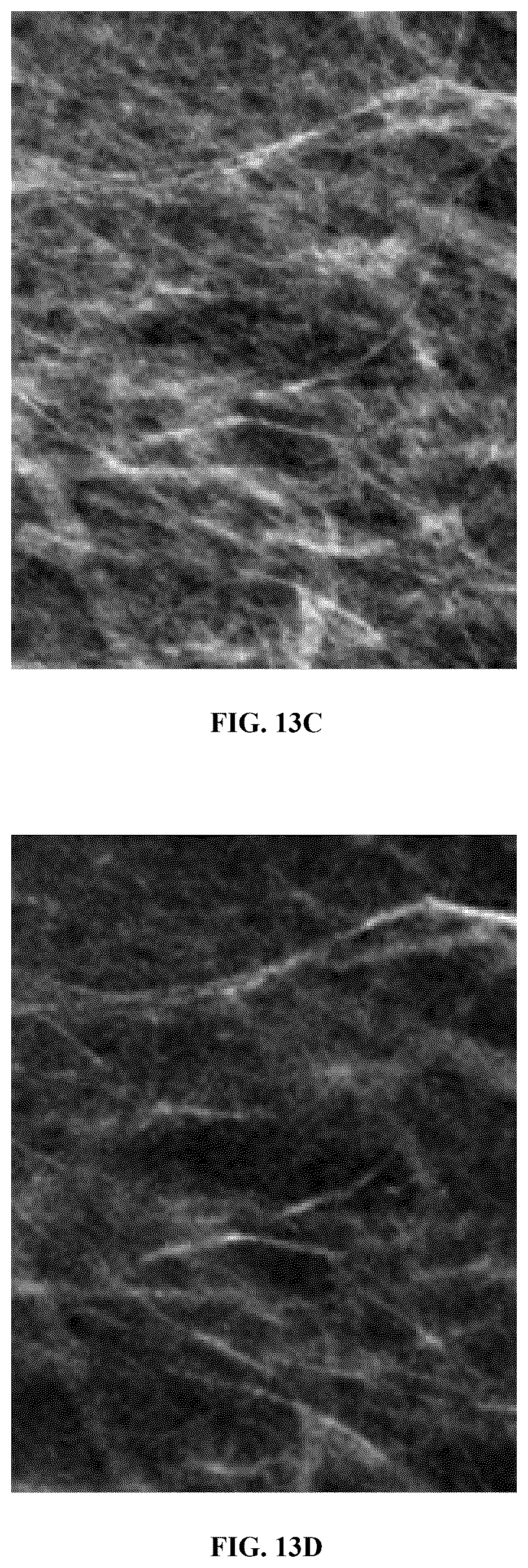Patent US12586360 Figure 18 – Methods and systems for monitoring and surveillance of autonomous AI in medical imaging