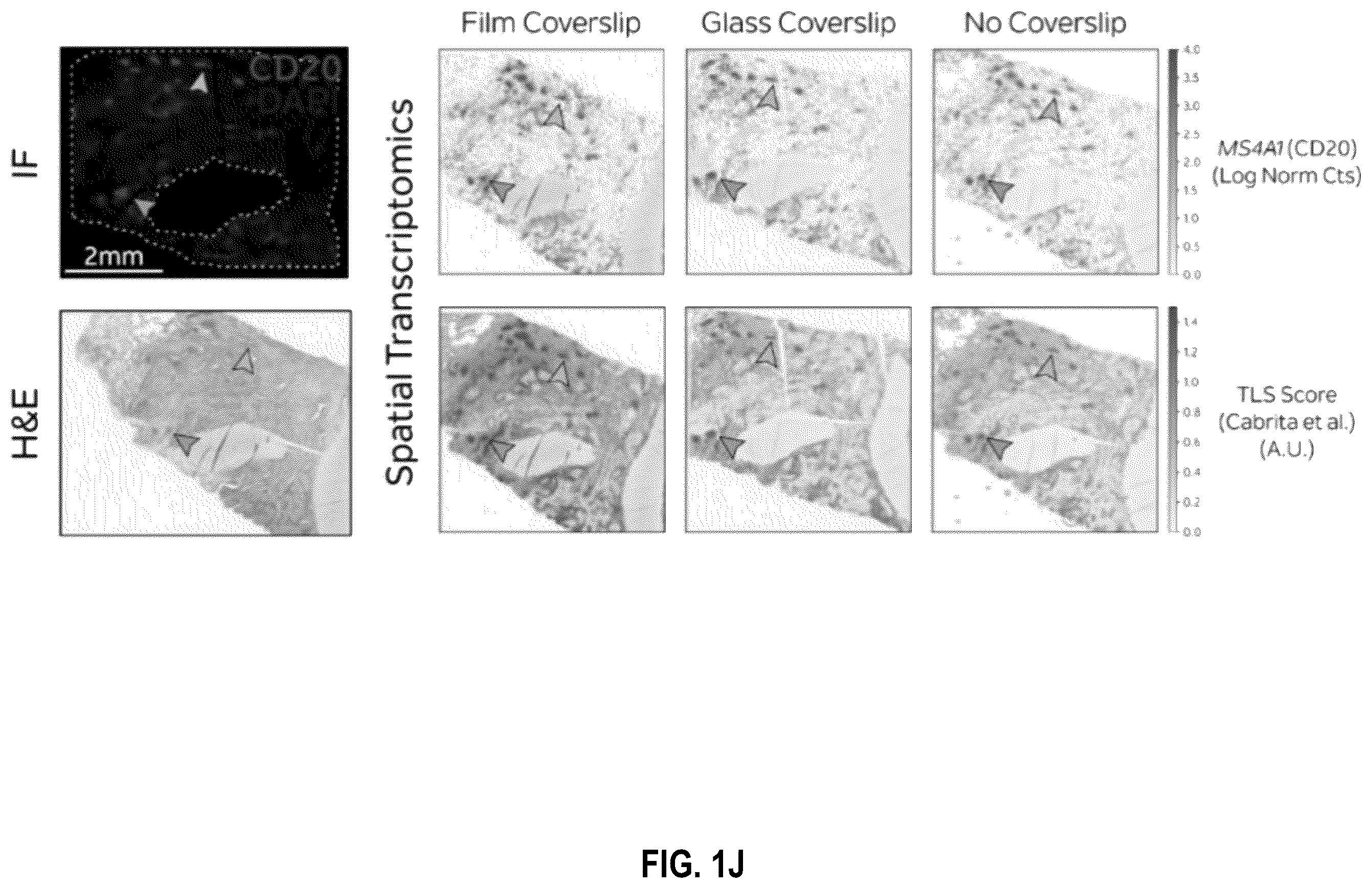 Patent US12586391 Figure 10 – Systems and methods for deconvolving cell types in histology slide images, using super-resolution spatial transcriptomics data