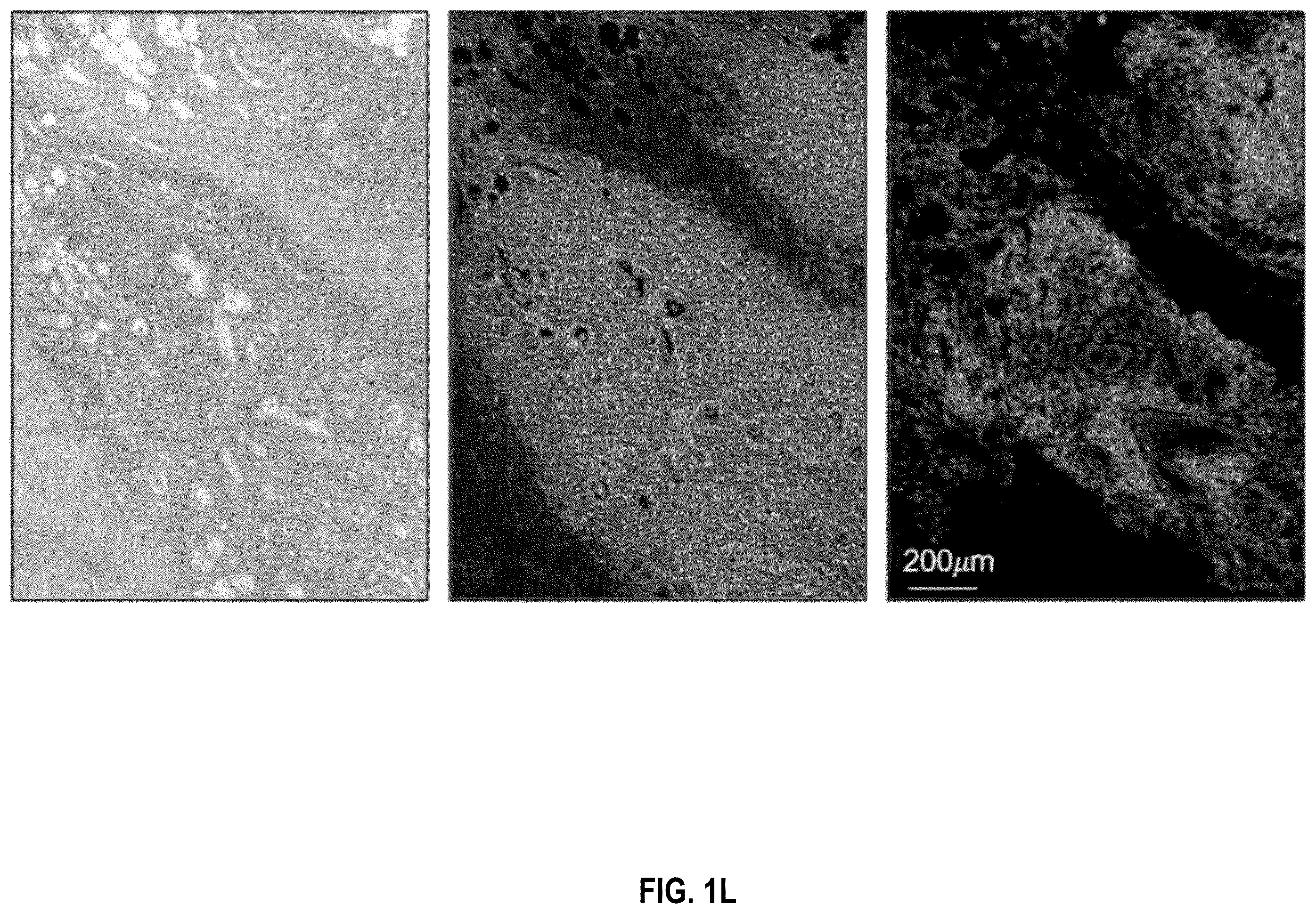 Patent US12586391 Figure 12 – Systems and methods for deconvolving cell types in histology slide images, using super-resolution spatial transcriptomics data