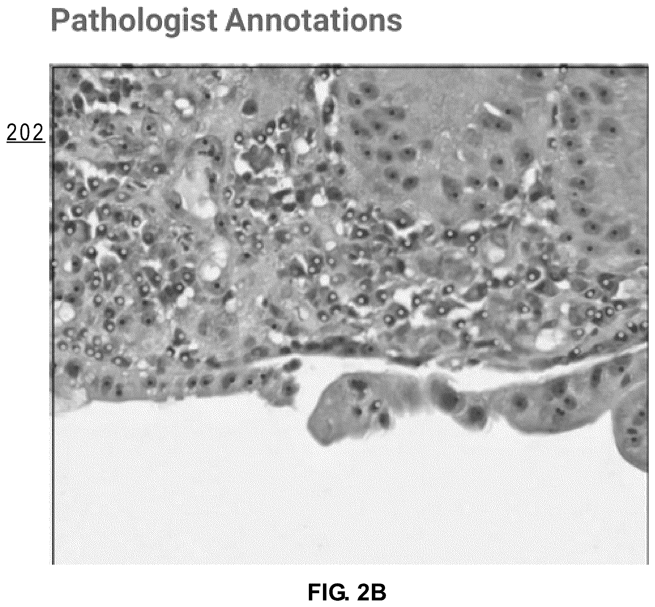 Patent US12586391 Figure 14 – Systems and methods for deconvolving cell types in histology slide images, using super-resolution spatial transcriptomics data