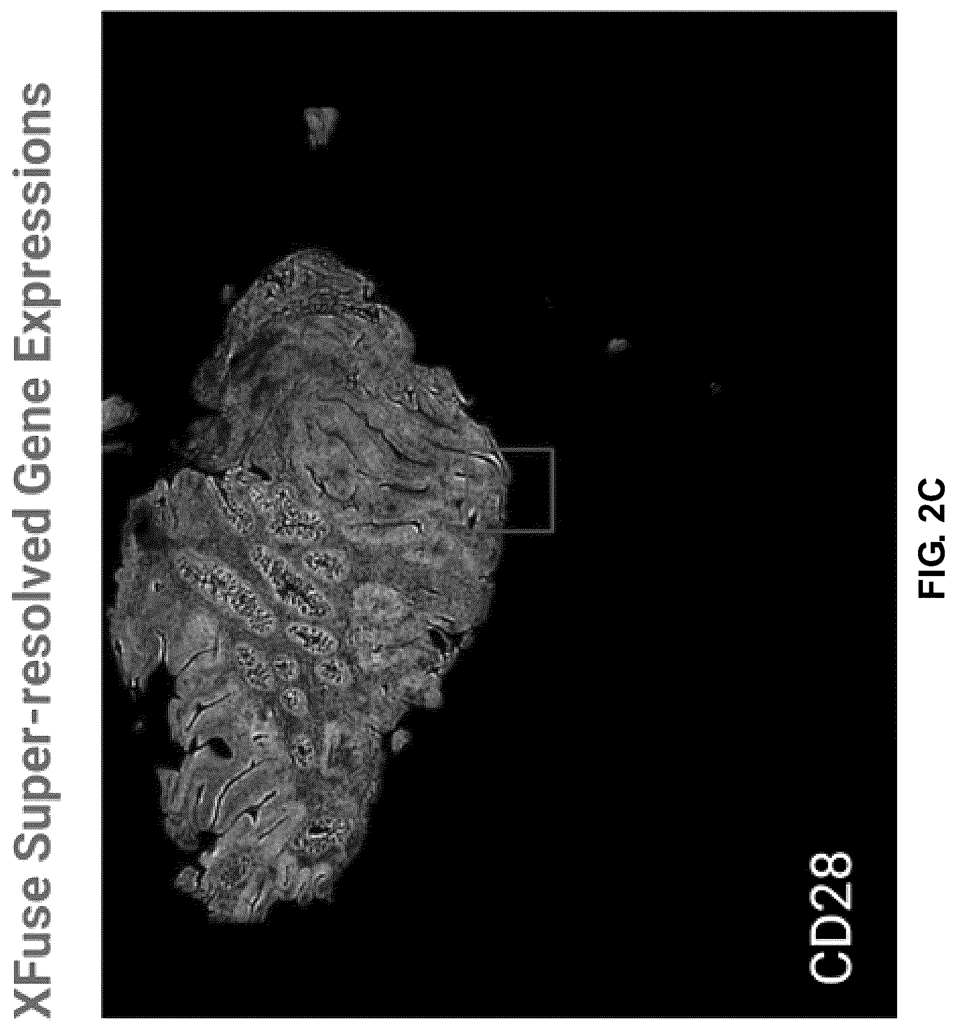 Patent US12586391 Figure 15 – Systems and methods for deconvolving cell types in histology slide images, using super-resolution spatial transcriptomics data