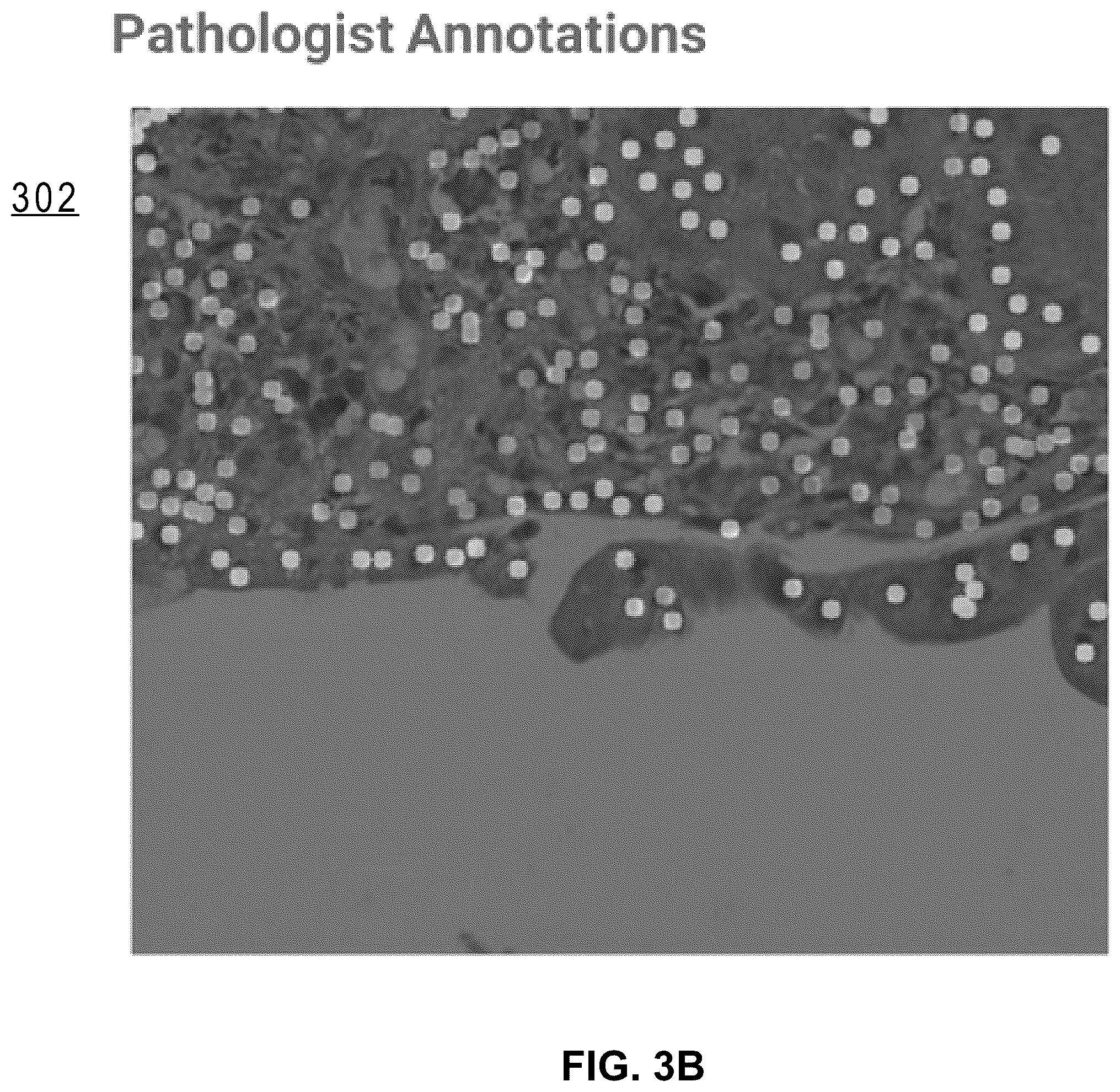 Patent US12586391 Figure 17 – Systems and methods for deconvolving cell types in histology slide images, using super-resolution spatial transcriptomics data