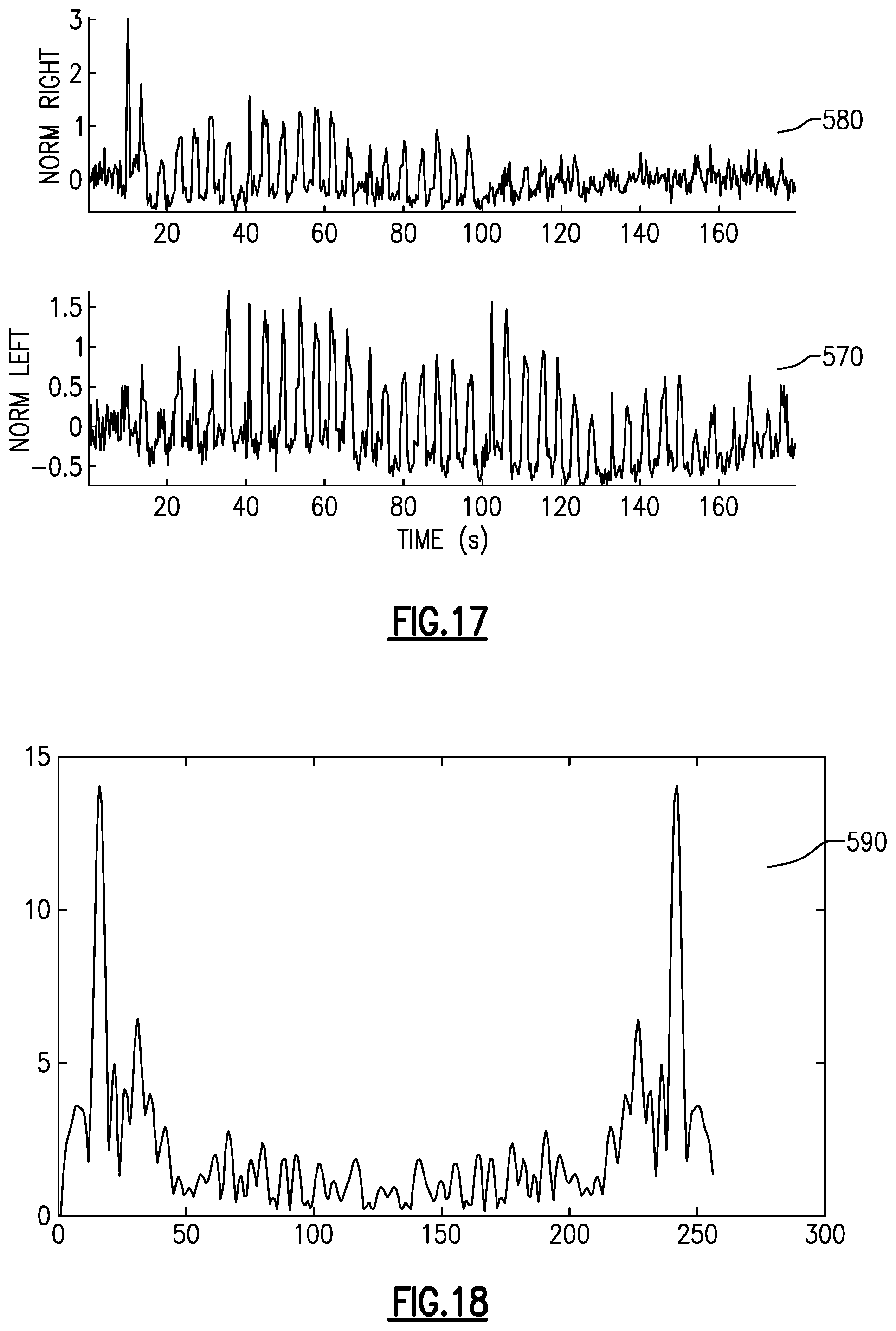Patent US12586601 Figure 10 – Snoring detection system