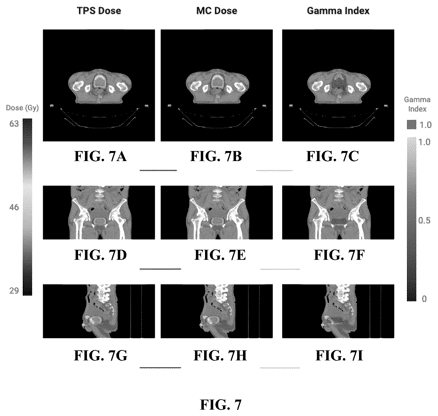Patent US12586670 Figure 7 – System and method for fast Monte Carlo Dose calculation using a virtual source model