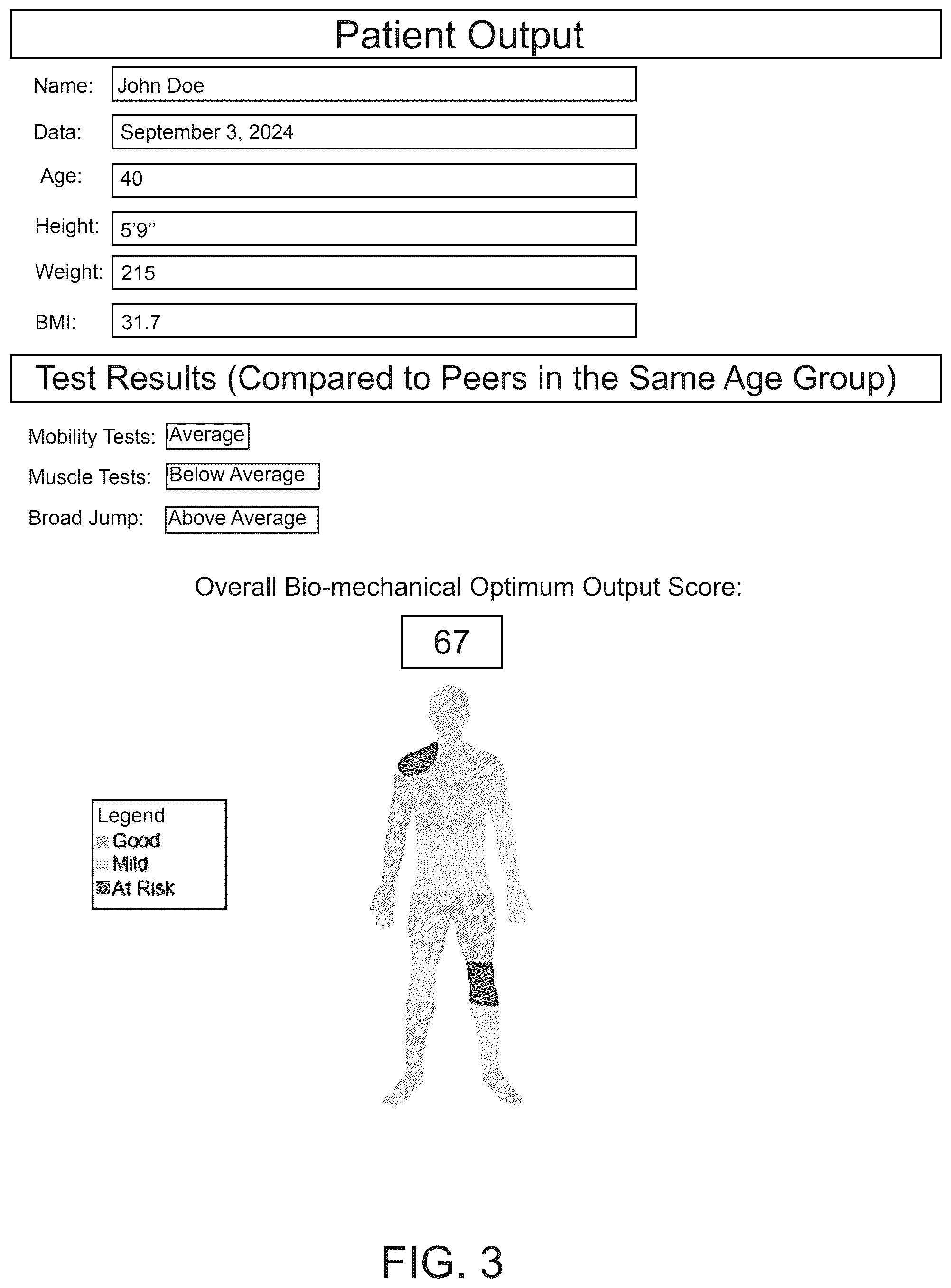 Patent US12586671 Figure 3 – Systems and methods for anatomical and injury modeling