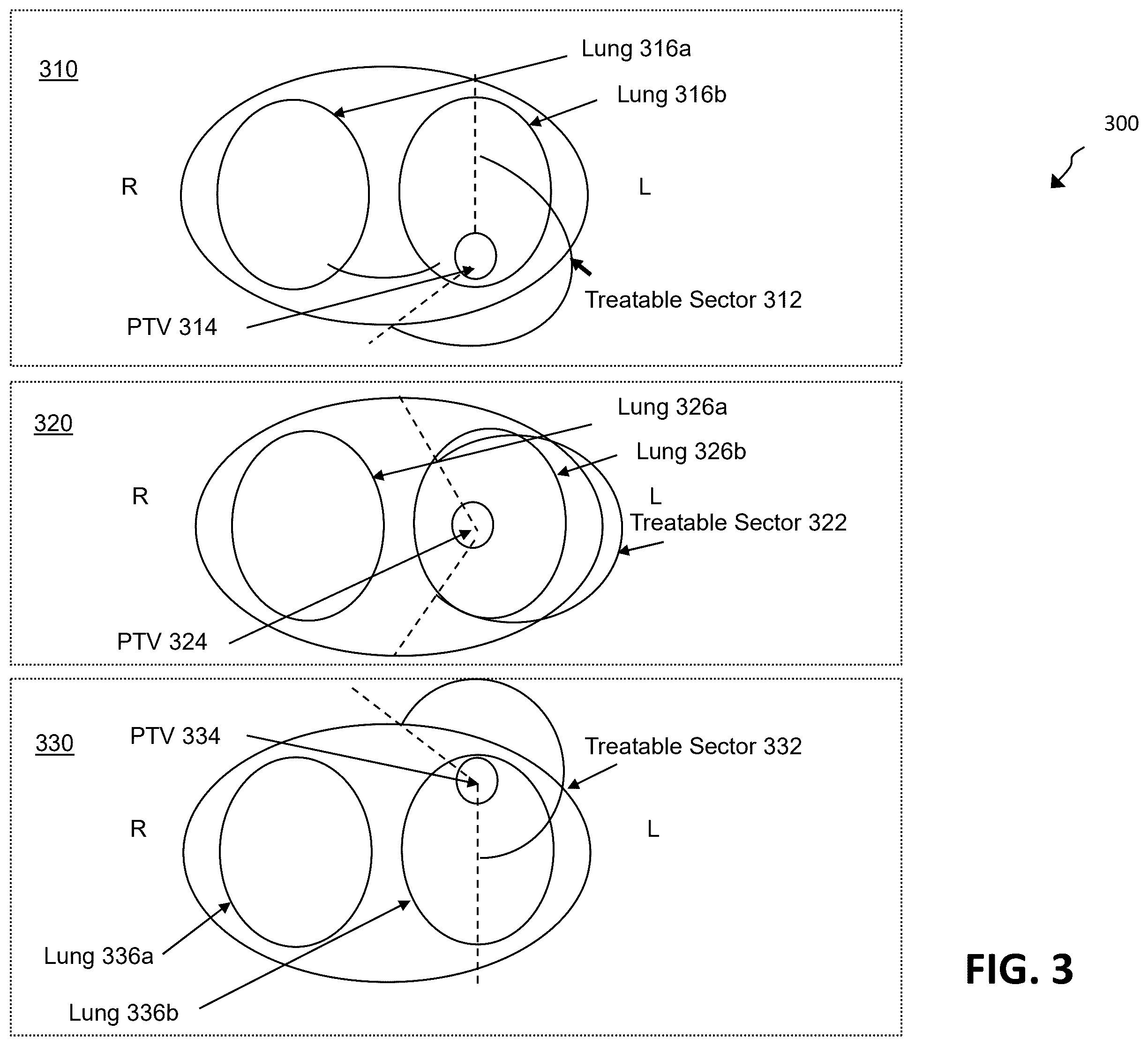 Patent US12586672 Figure 4 – Intelligent treatable sectors for radiation therapy plan generation