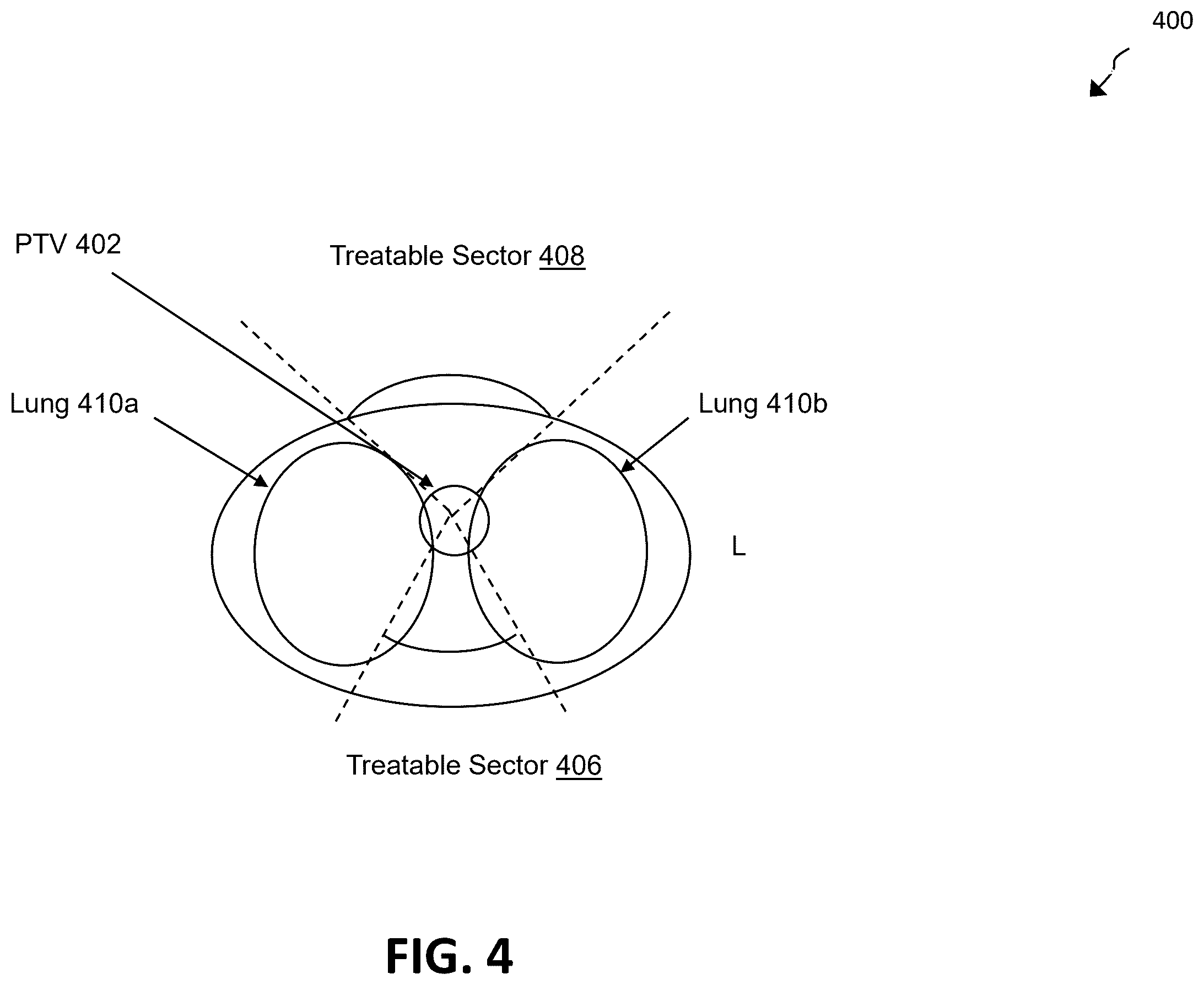 Patent US12586672 Figure 5 – Intelligent treatable sectors for radiation therapy plan generation