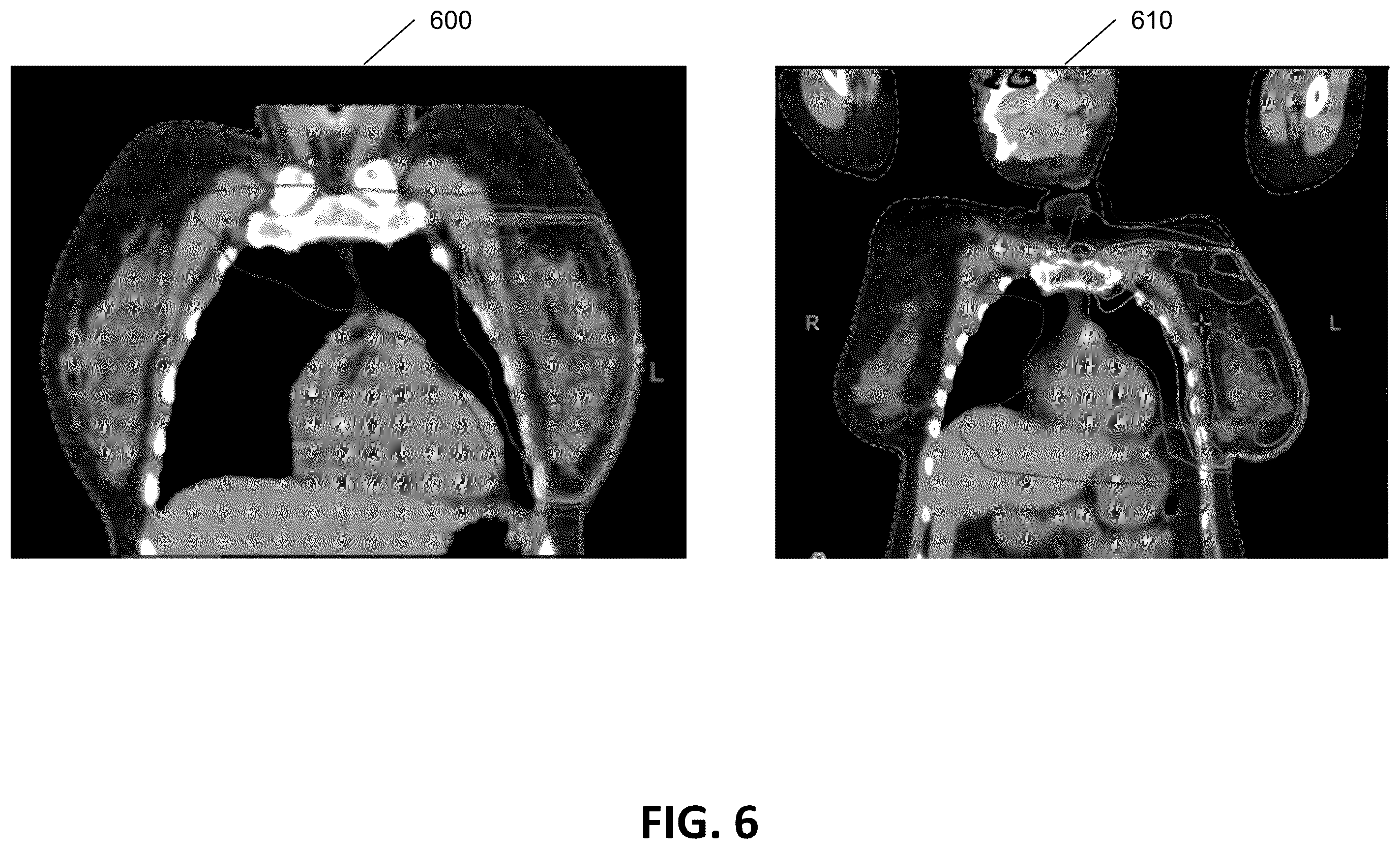 Patent US12586672 Figure 7 – Intelligent treatable sectors for radiation therapy plan generation
