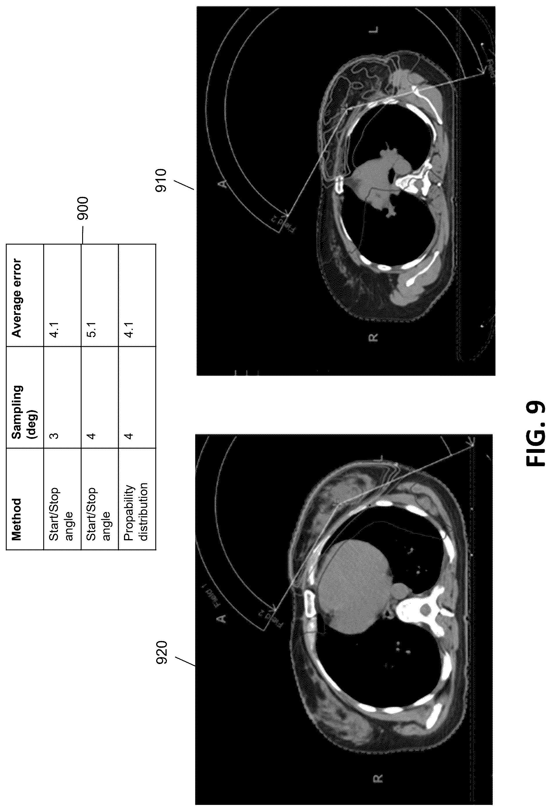 Patent US12586672 Figure 10 – Intelligent treatable sectors for radiation therapy plan generation