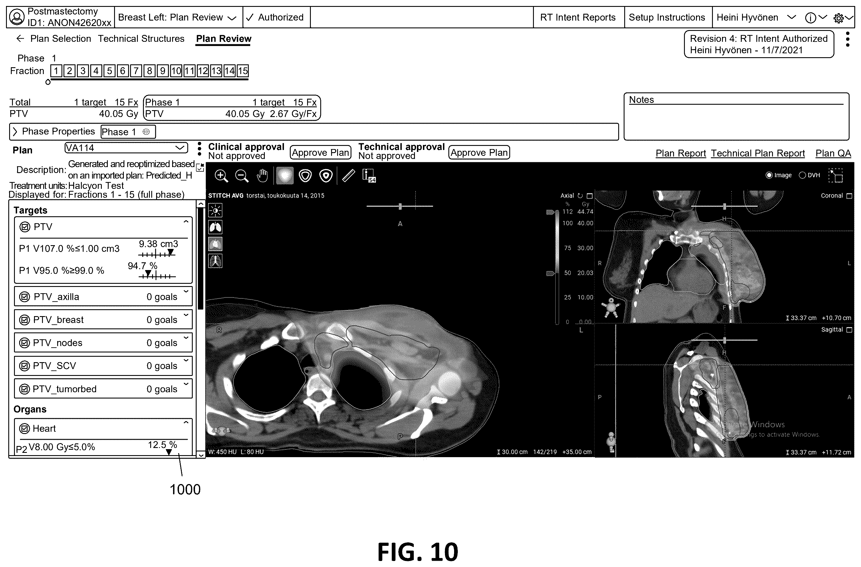 Patent US12586672 Figure 11 – Intelligent treatable sectors for radiation therapy plan generation