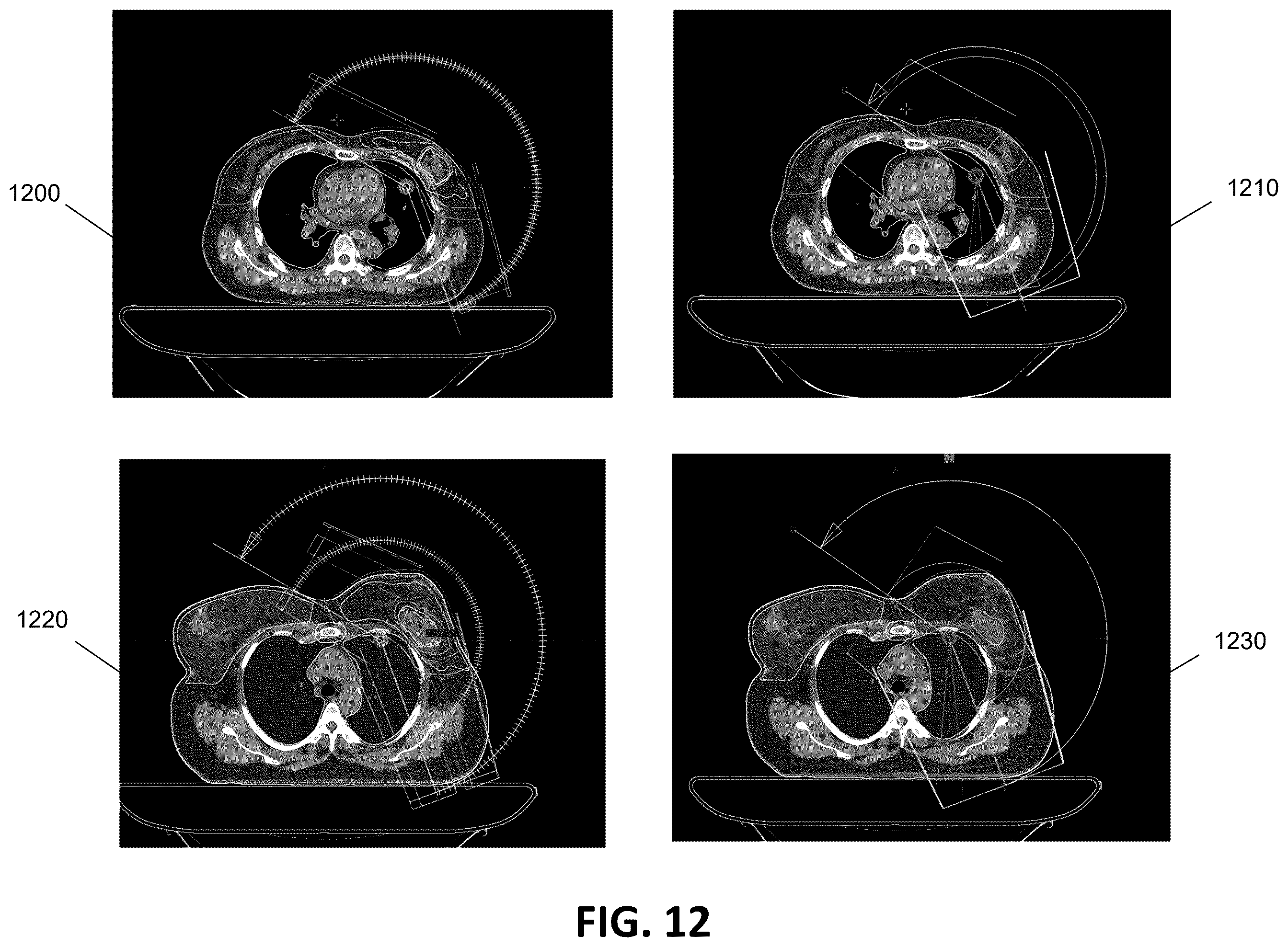 Patent US12586672 Figure 13 – Intelligent treatable sectors for radiation therapy plan generation