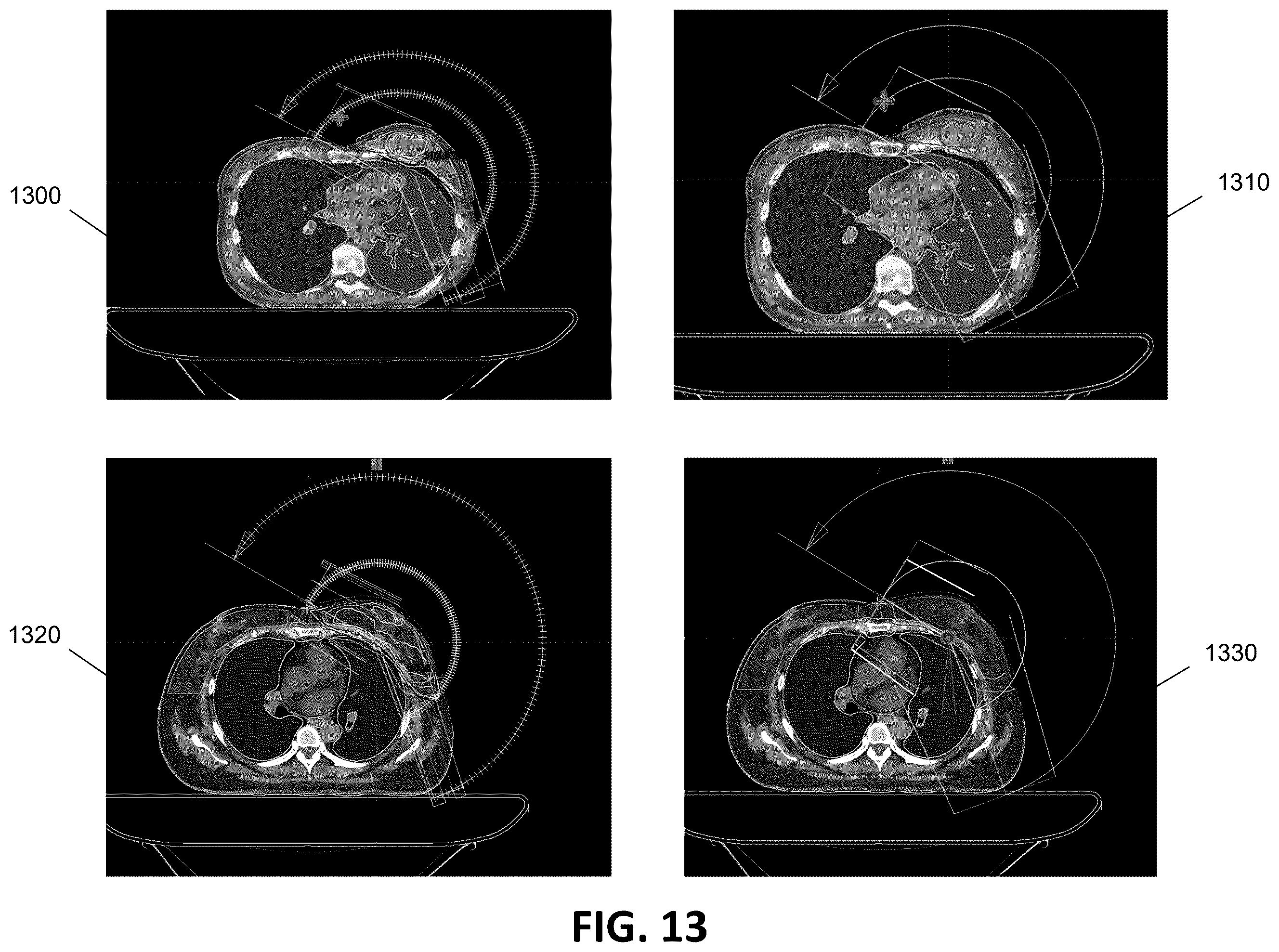 Patent US12586672 Figure 14 – Intelligent treatable sectors for radiation therapy plan generation