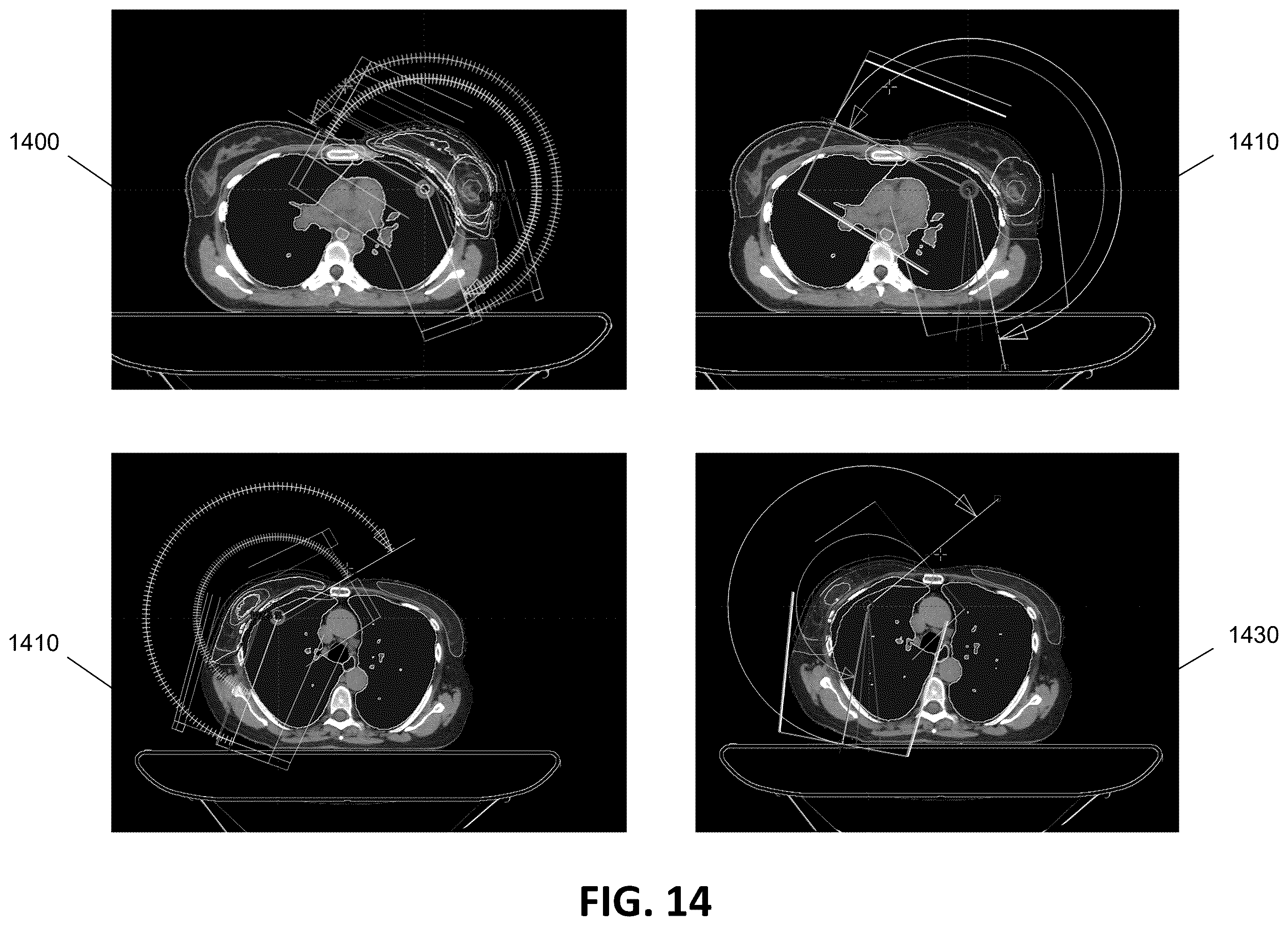 Patent US12586672 Figure 15 – Intelligent treatable sectors for radiation therapy plan generation
