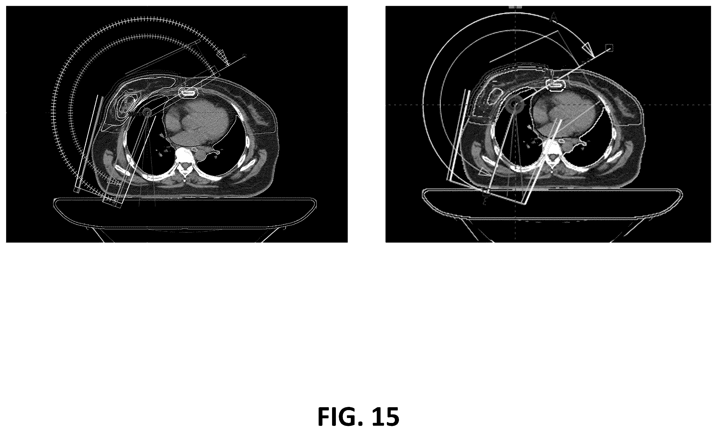 Patent US12586672 Figure 16 – Intelligent treatable sectors for radiation therapy plan generation