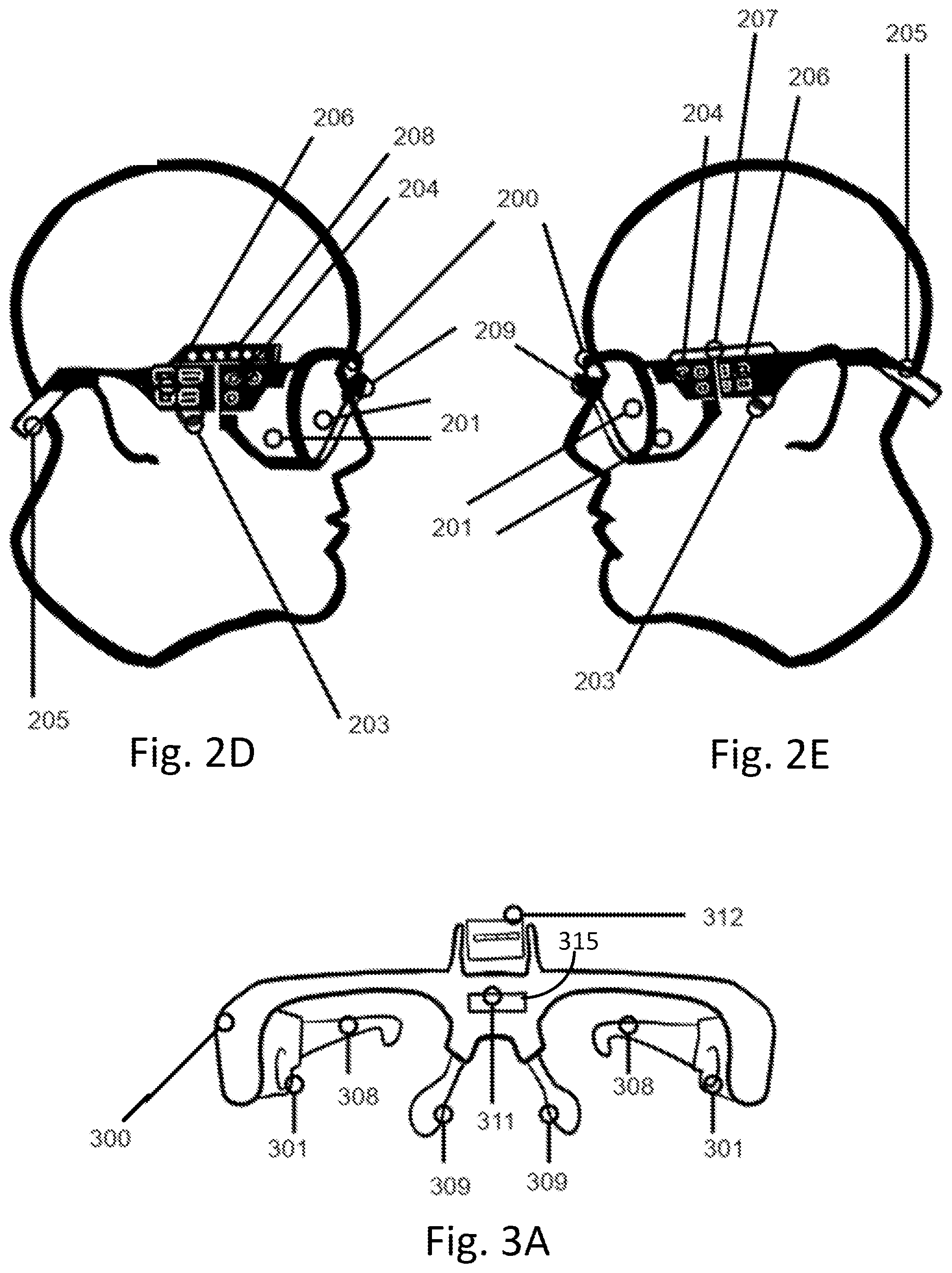 Patent US12586681 Figure 3 – Clinical personal protective equipment with integrated display and medical device control system