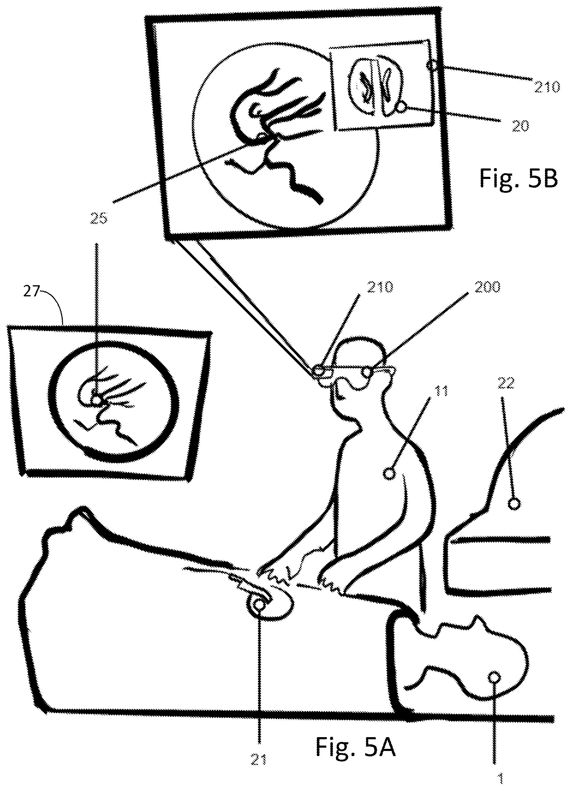 Patent US12586681 Figure 6 – Clinical personal protective equipment with integrated display and medical device control system