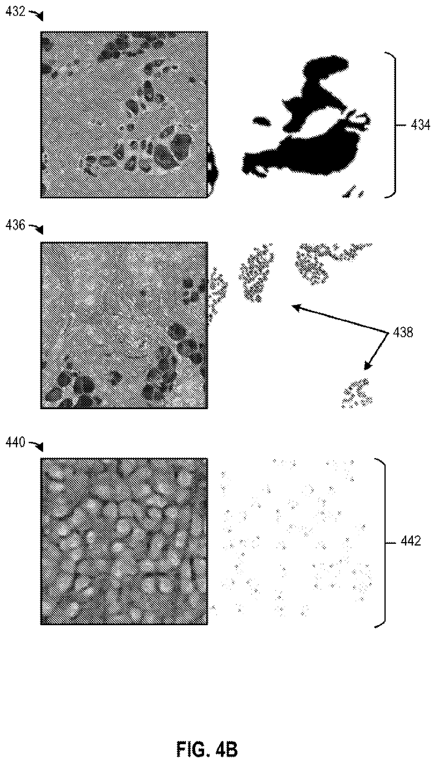 Patent US12586685 Figure 6 – Multimodal machine learning based clinical predictor
