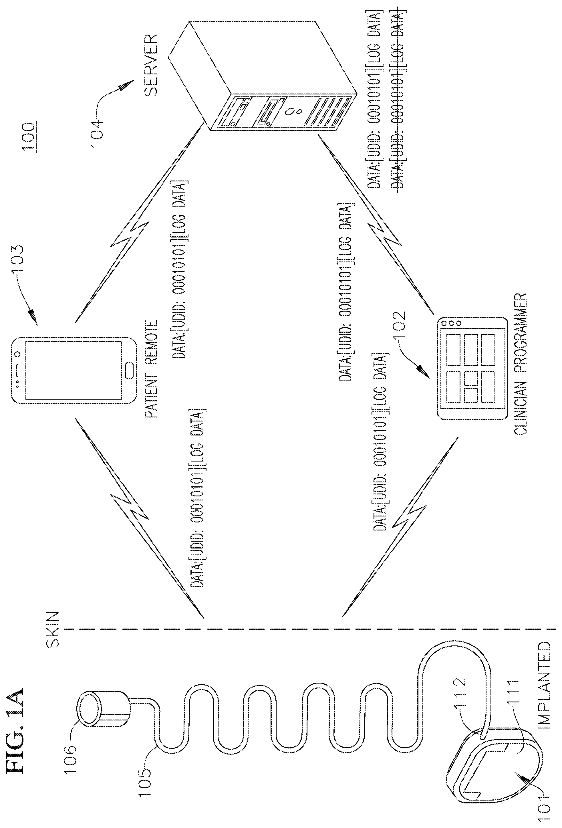 Patent US12586687 Figure 1 – Systems and methods of deduplicating data collected by an implantable medical device