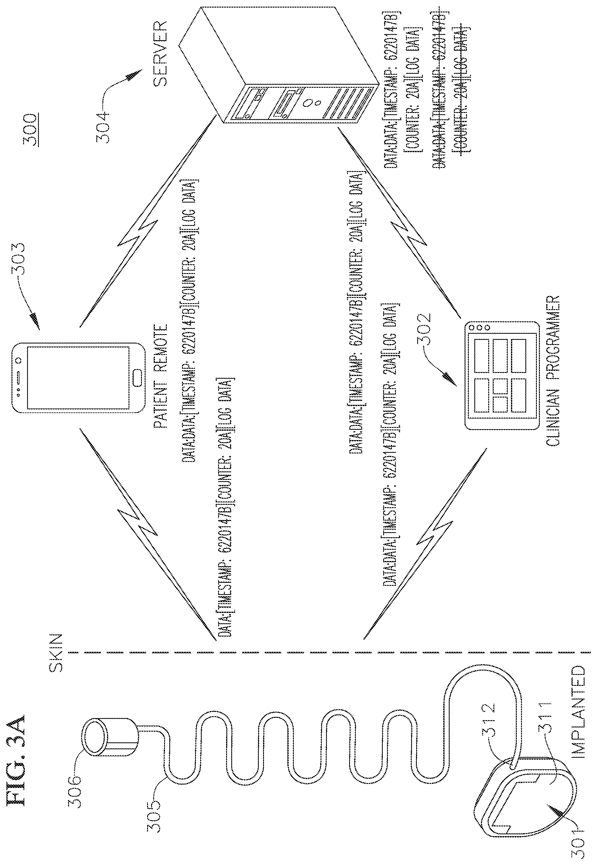 Patent US12586687 Figure 4 – Systems and methods of deduplicating data collected by an implantable medical device