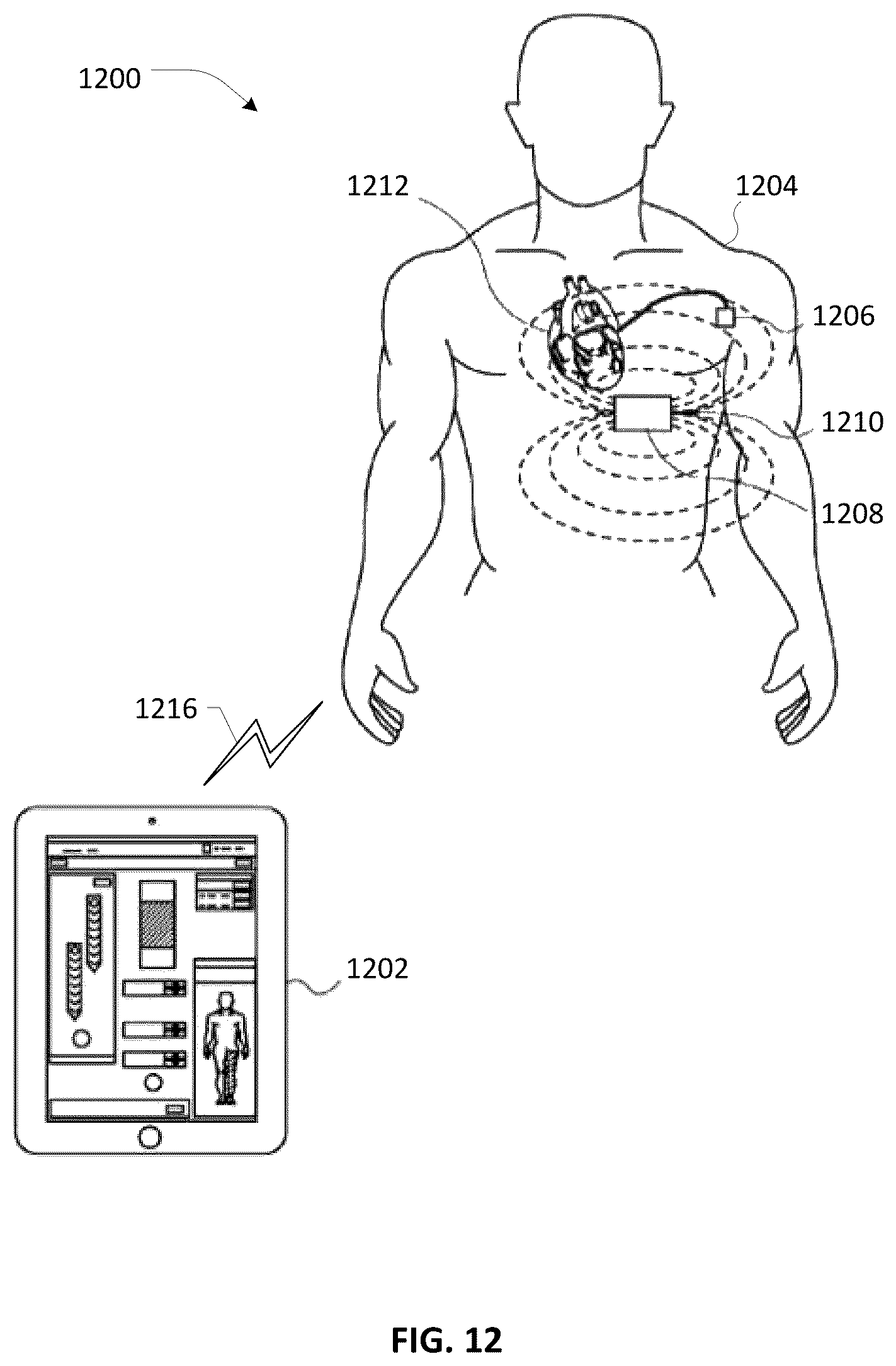 Patent US12586689 Figure 18 – UI design for patient and clinician controller devices operative in a remote care architecture