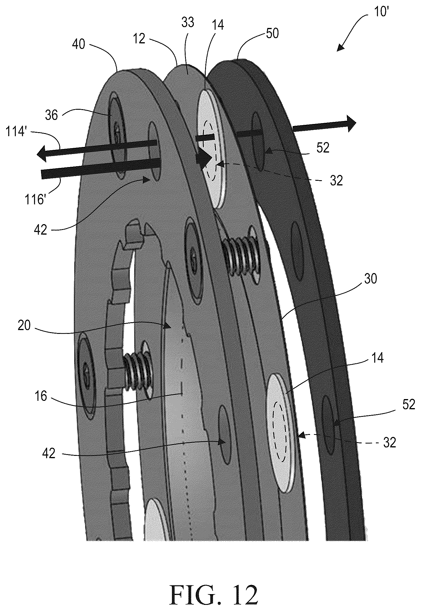Patent US12586861 Figure 6 – Breathable overpressure assembly