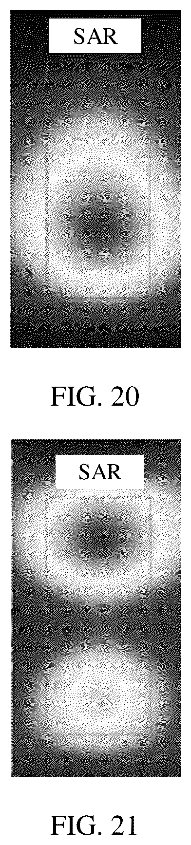 Patent US12586909 Figure 14 – Microstrip antenna and electronic device