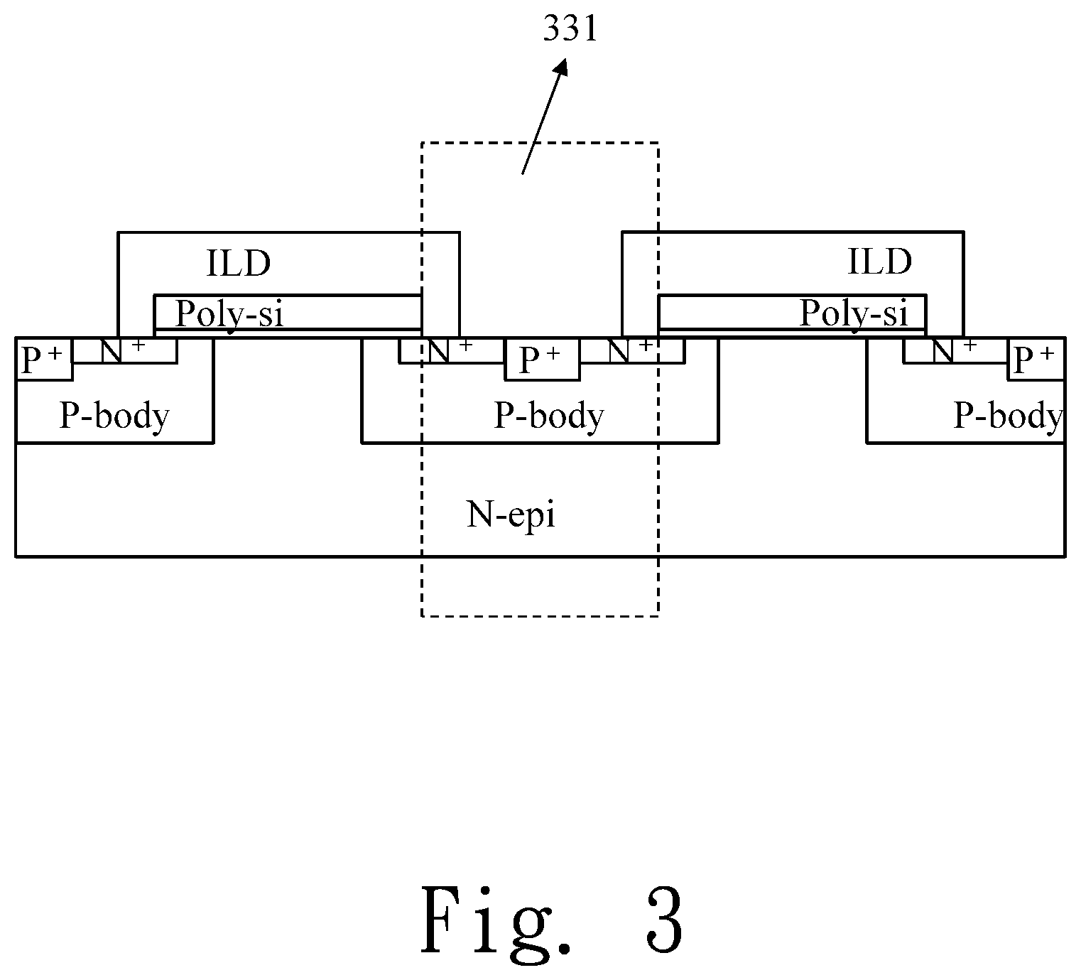 Patent US12588264 Figure 3 – Three-dimensional source contact structure and fabrication process method of making the same
